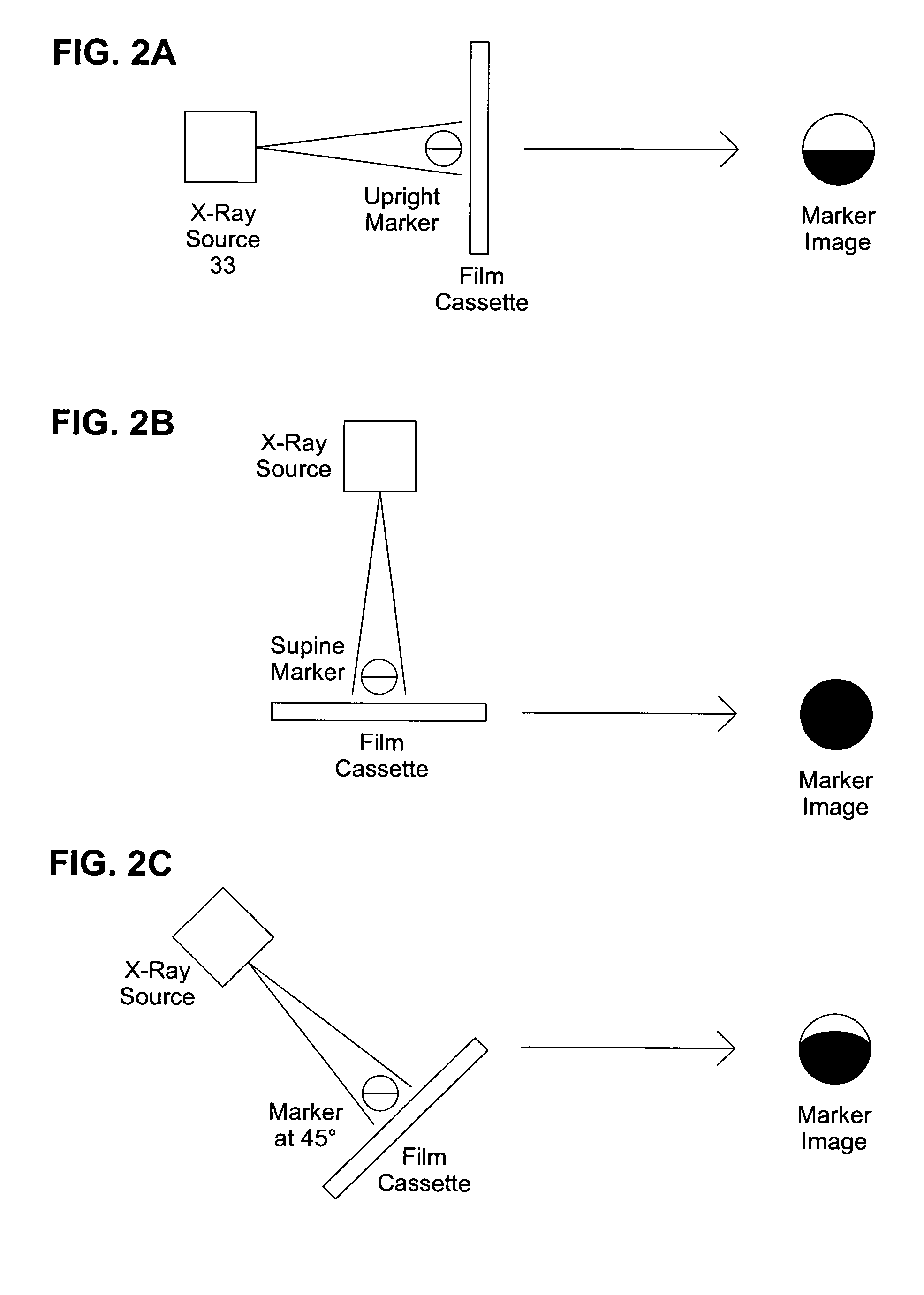 Universal radiologic patient positioning marker