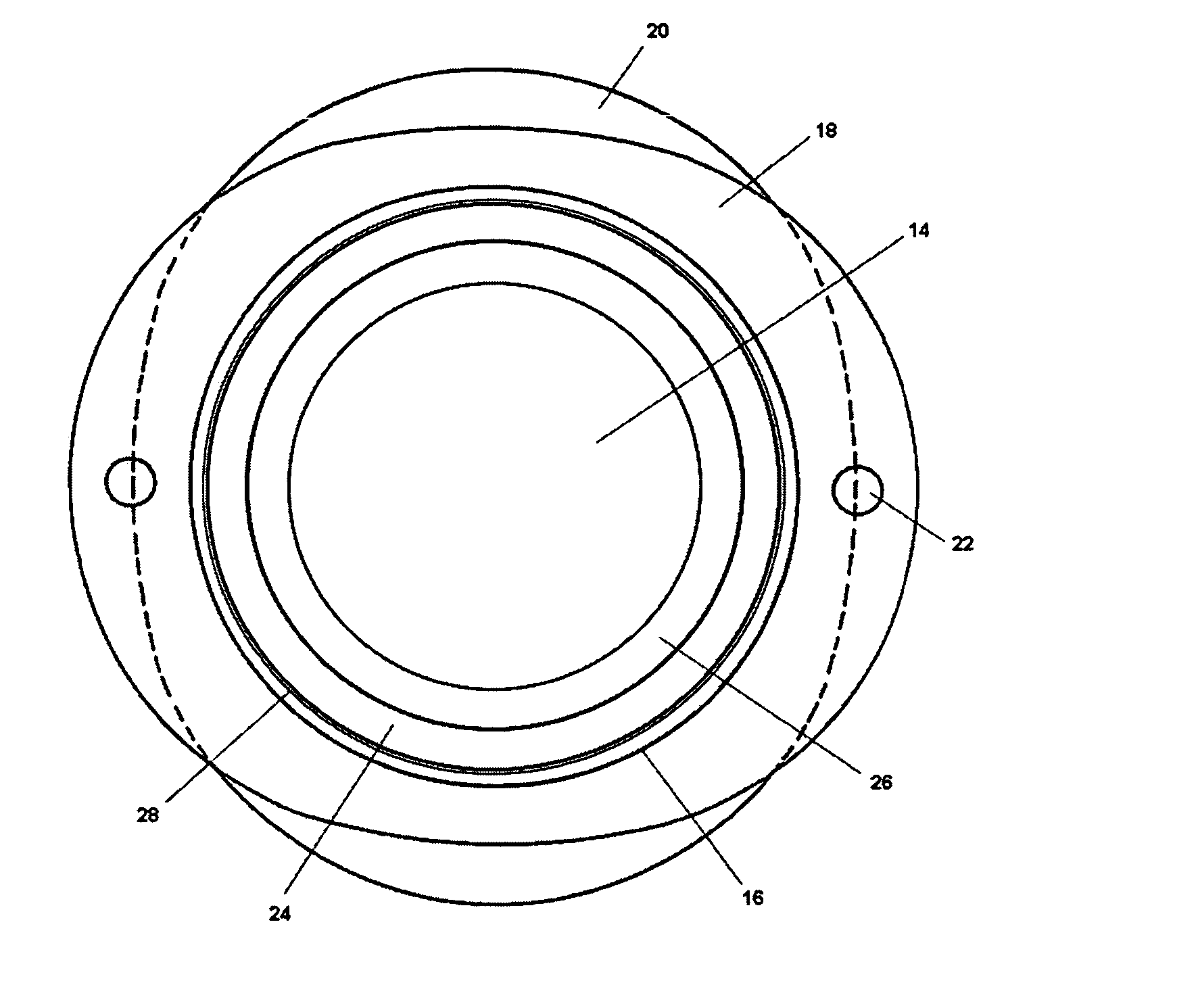 Bag-in-the-lens intraocular lens with removable optic and capsular accommodation ring