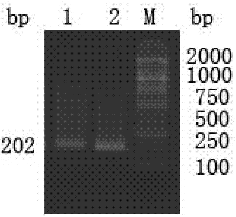 Chicken muscle fiber-type property-related gene molecule marker and use thereof