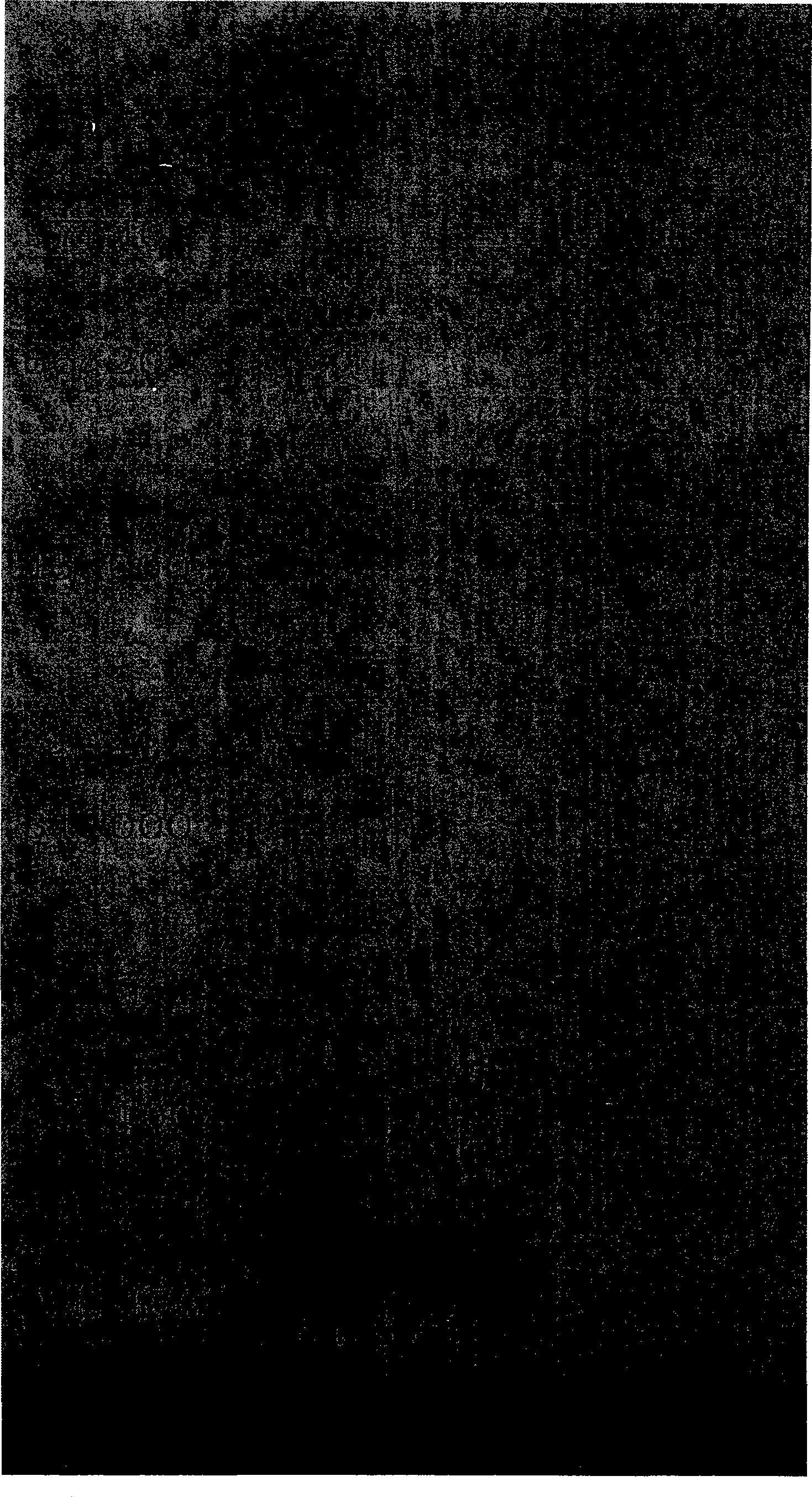 Polyethyleneglycol modified aprotinin and preparation thereof