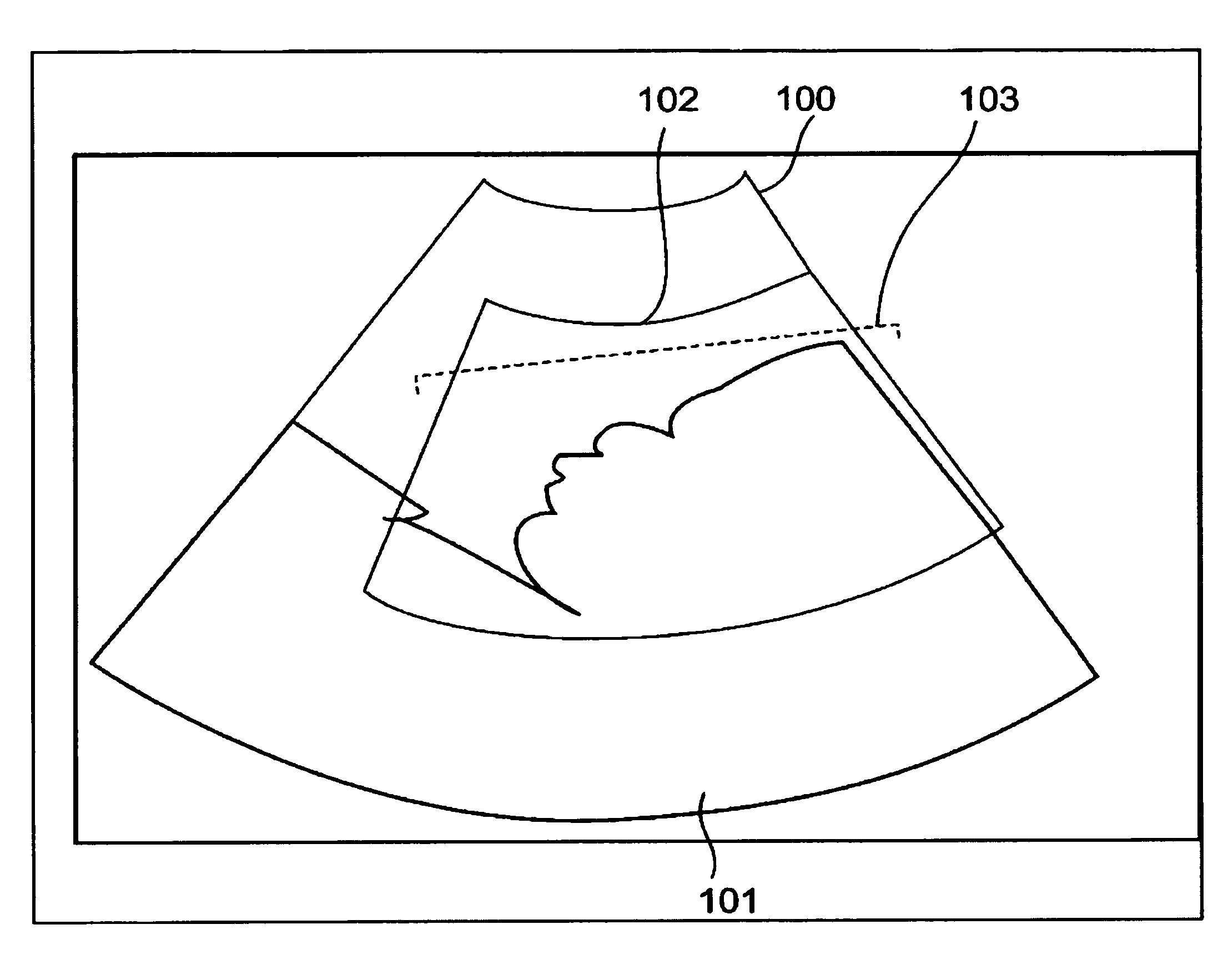 Ultrasound imaging apparatus and method for acquiring ultrasound image