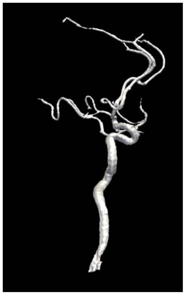 Method and system for intercepting intracranial blood vessel images based on centerline