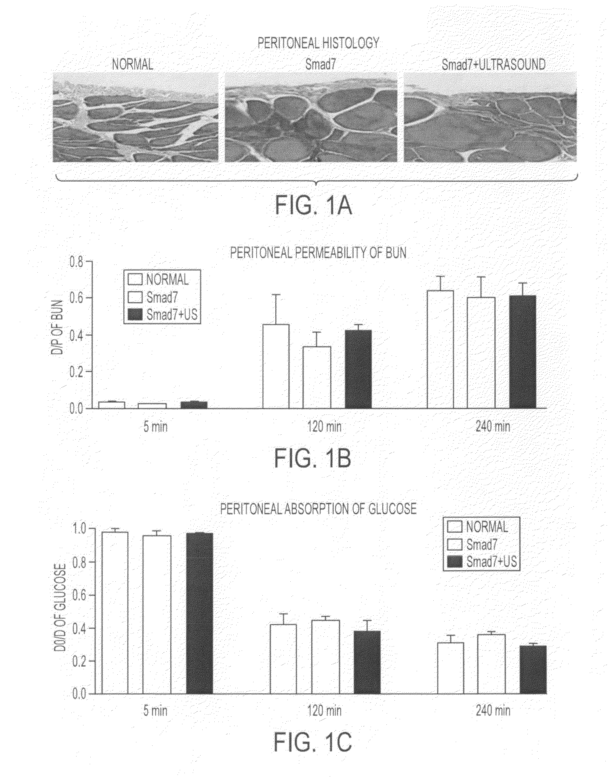 Ultrasound Microbubble Mediated Genes Delivery System