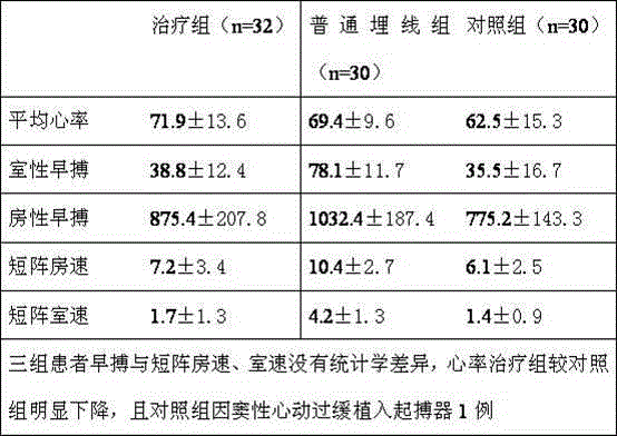 Compound traditional Chinese medicine preparation for treating arrhythmia and medicated thread thereof