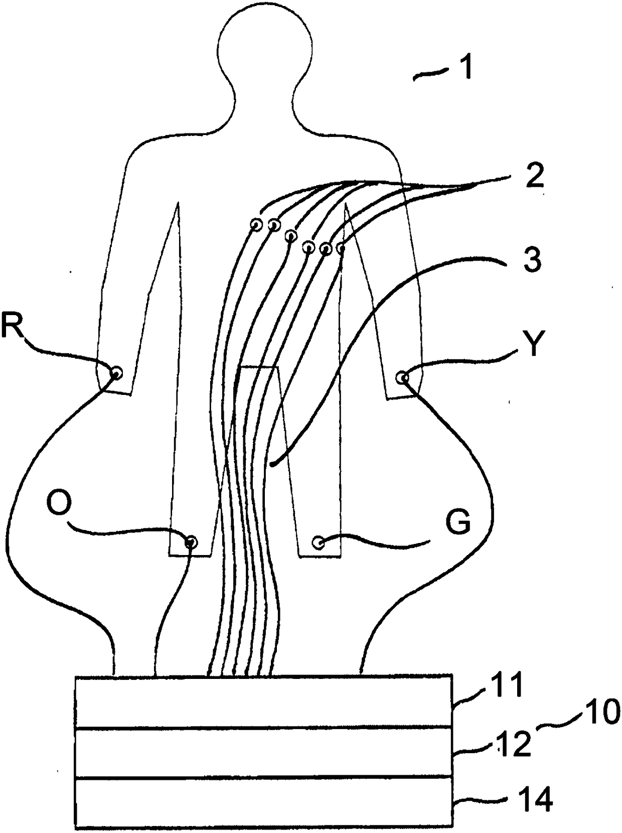 Data processing apparatus for assessing a condition of a myocardium