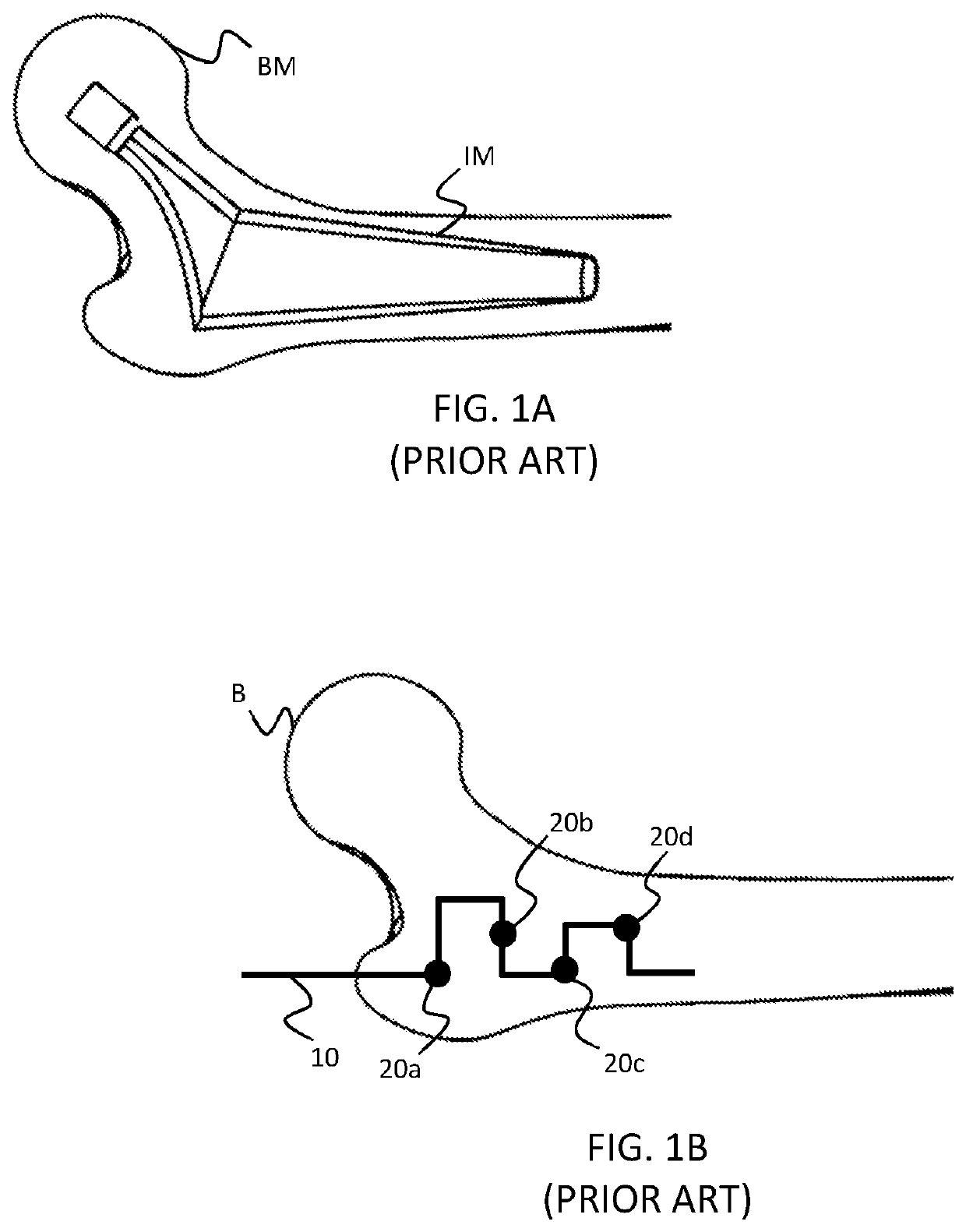 Environmental mapping for robotic assisted surgery