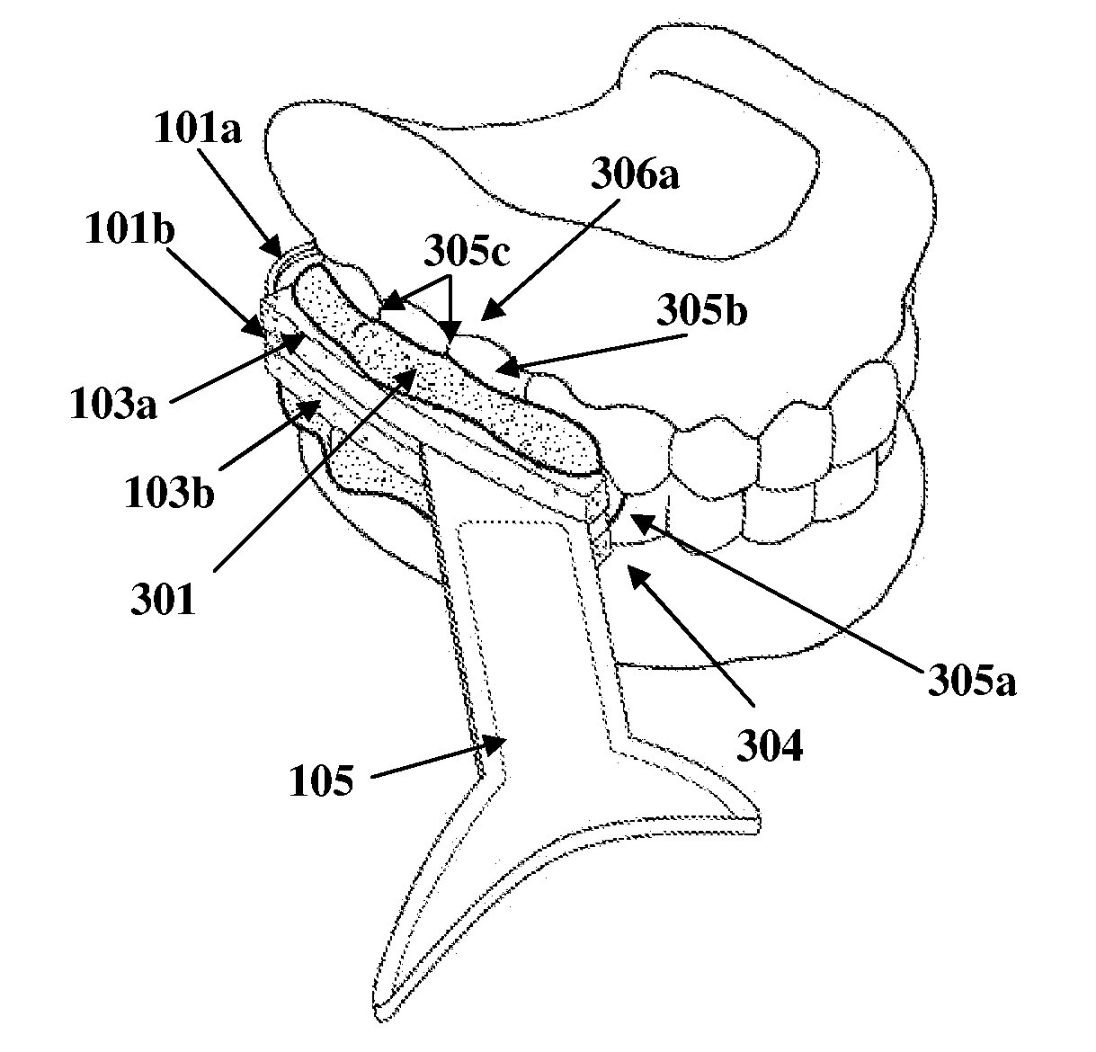 Dental Impression Apparatus