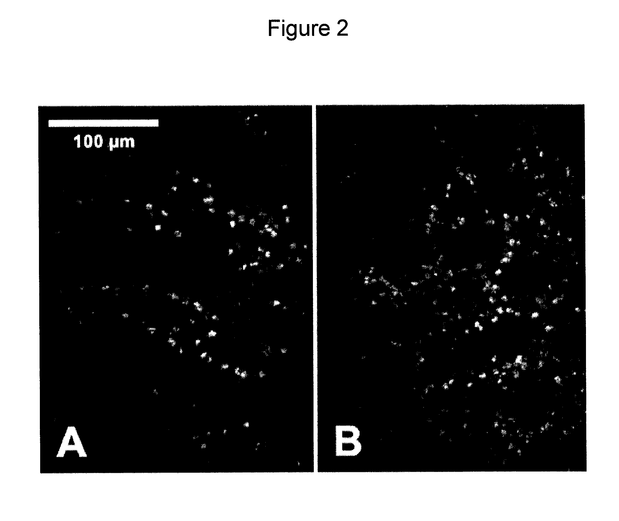 Endoscopic biopsy apparatus, system and method