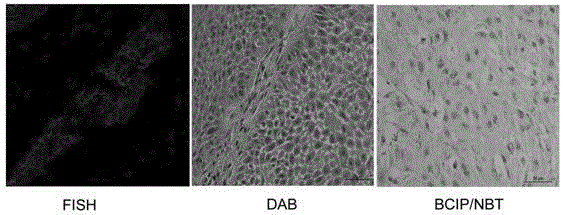 Fluorescence in situ hybridization detection method of IncRNA in esophageal squamous carcinoma tissues