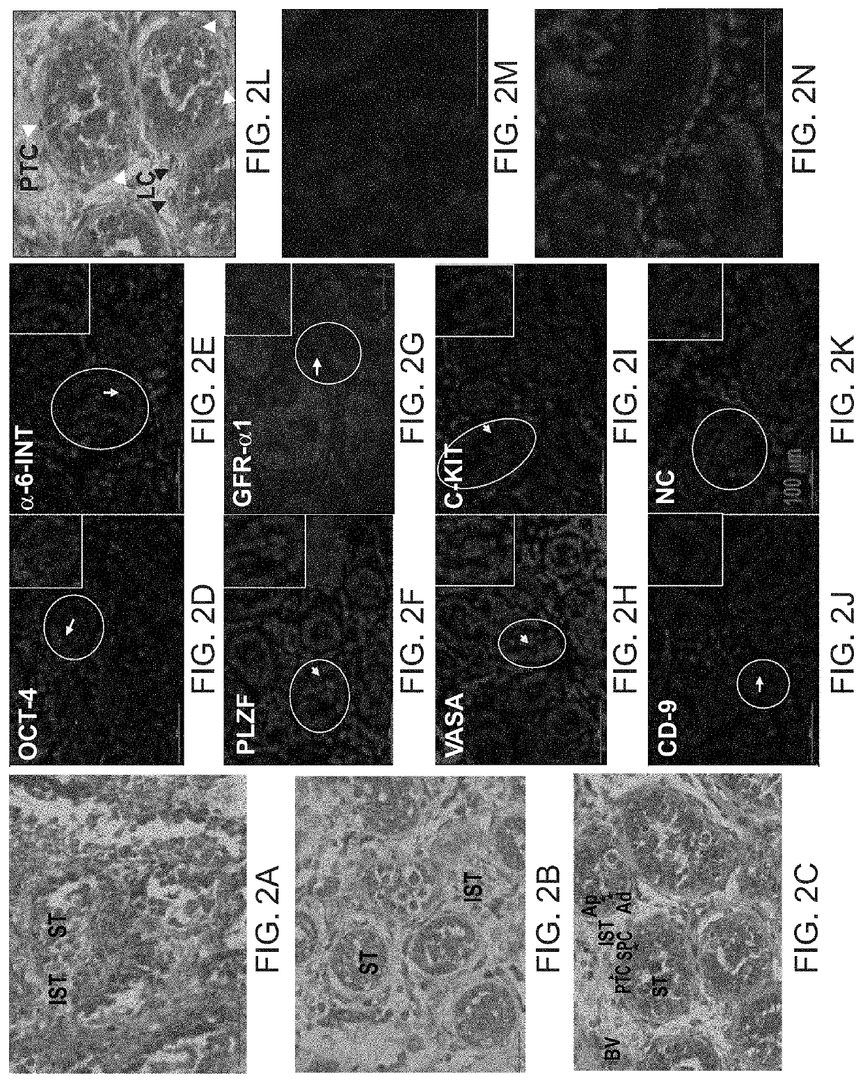 Methods of maturation of human spermatogonium