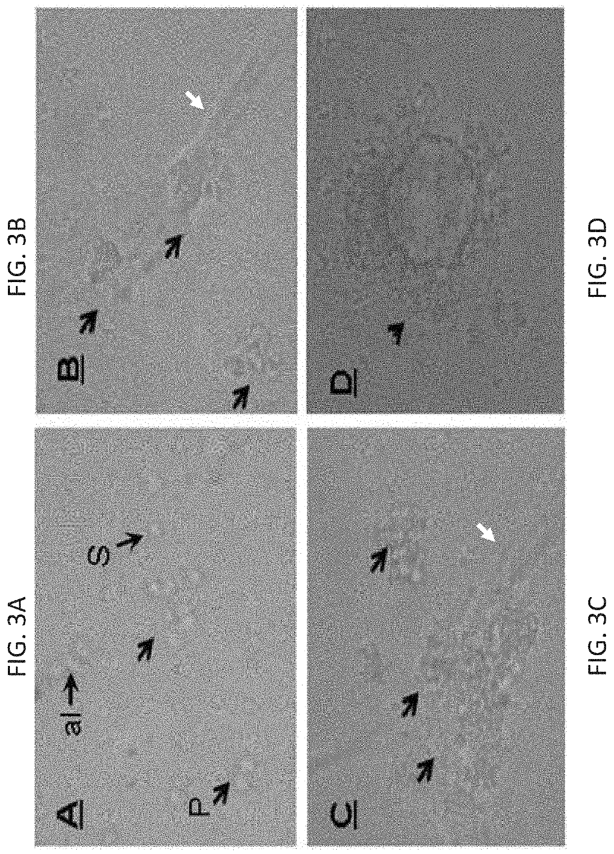 Methods of maturation of human spermatogonium