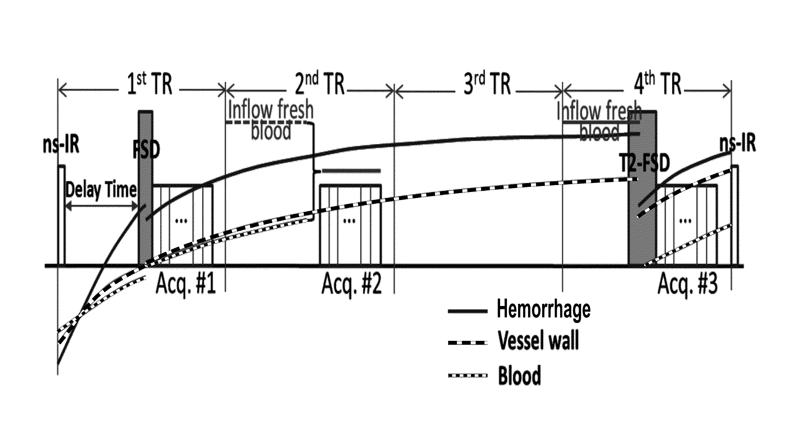 Atherosclerosis characterization using a multi-contrast MRI sequence