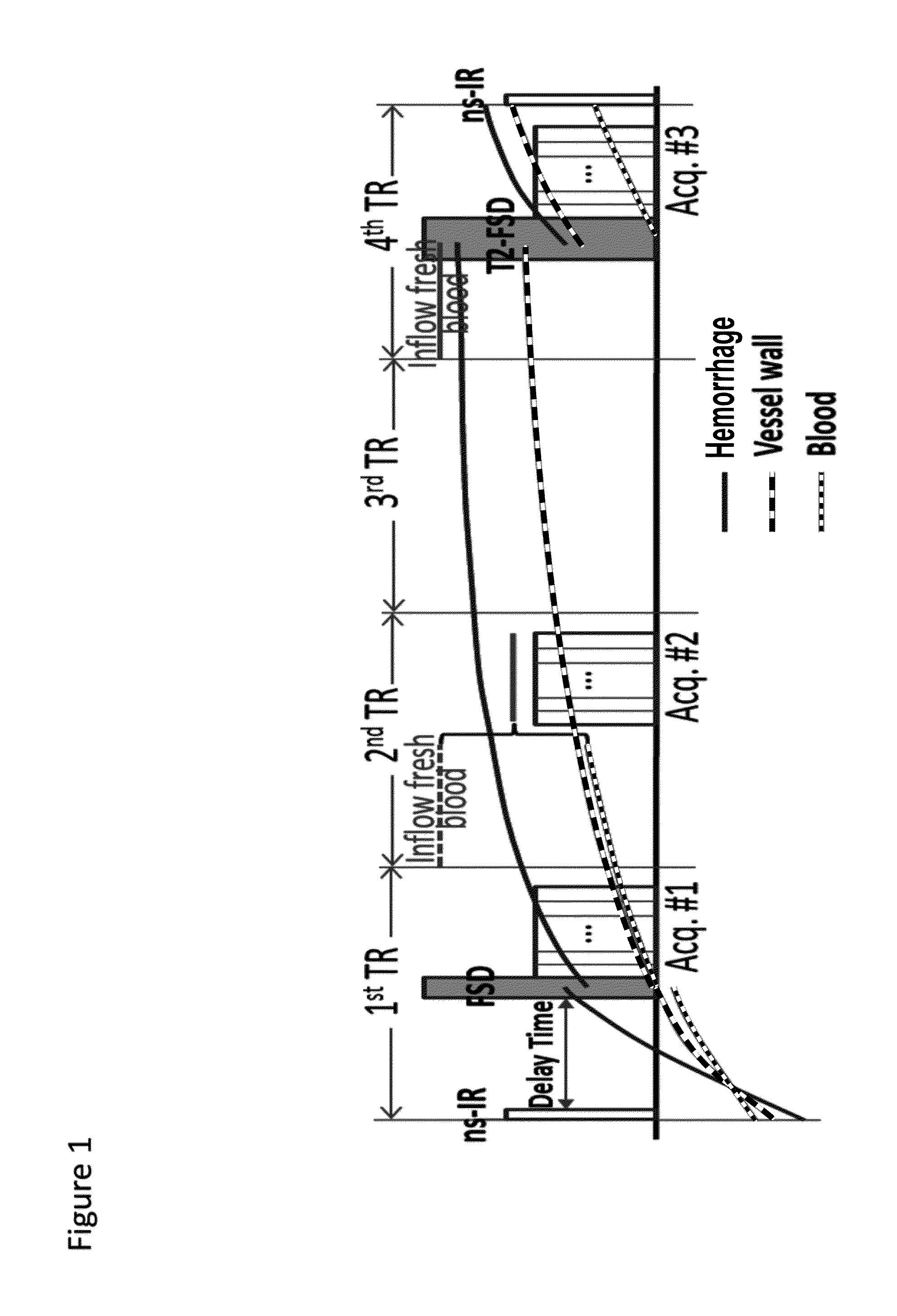 Atherosclerosis characterization using a multi-contrast MRI sequence