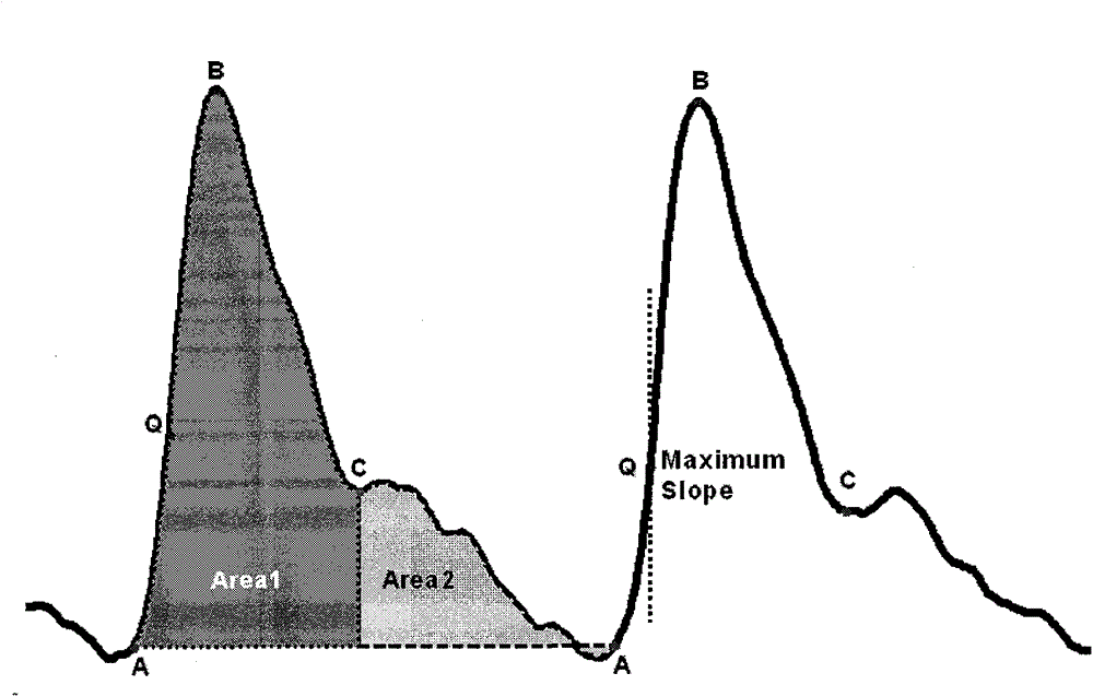 Method for estimating exercise load level based on cardiogenic signals