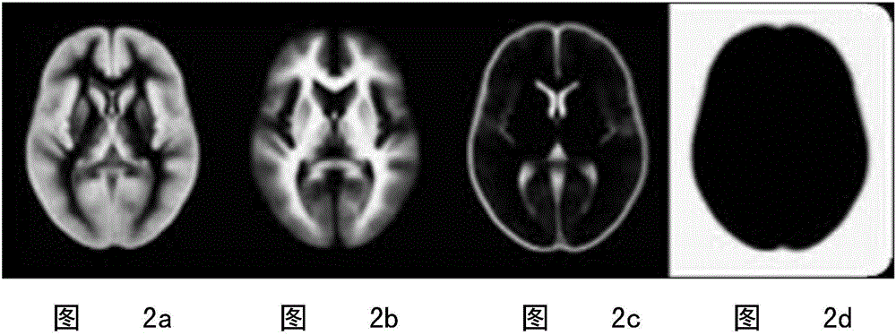 Method for three-dimensional registration and brain tissue extraction of individual human brain multimodality medical images