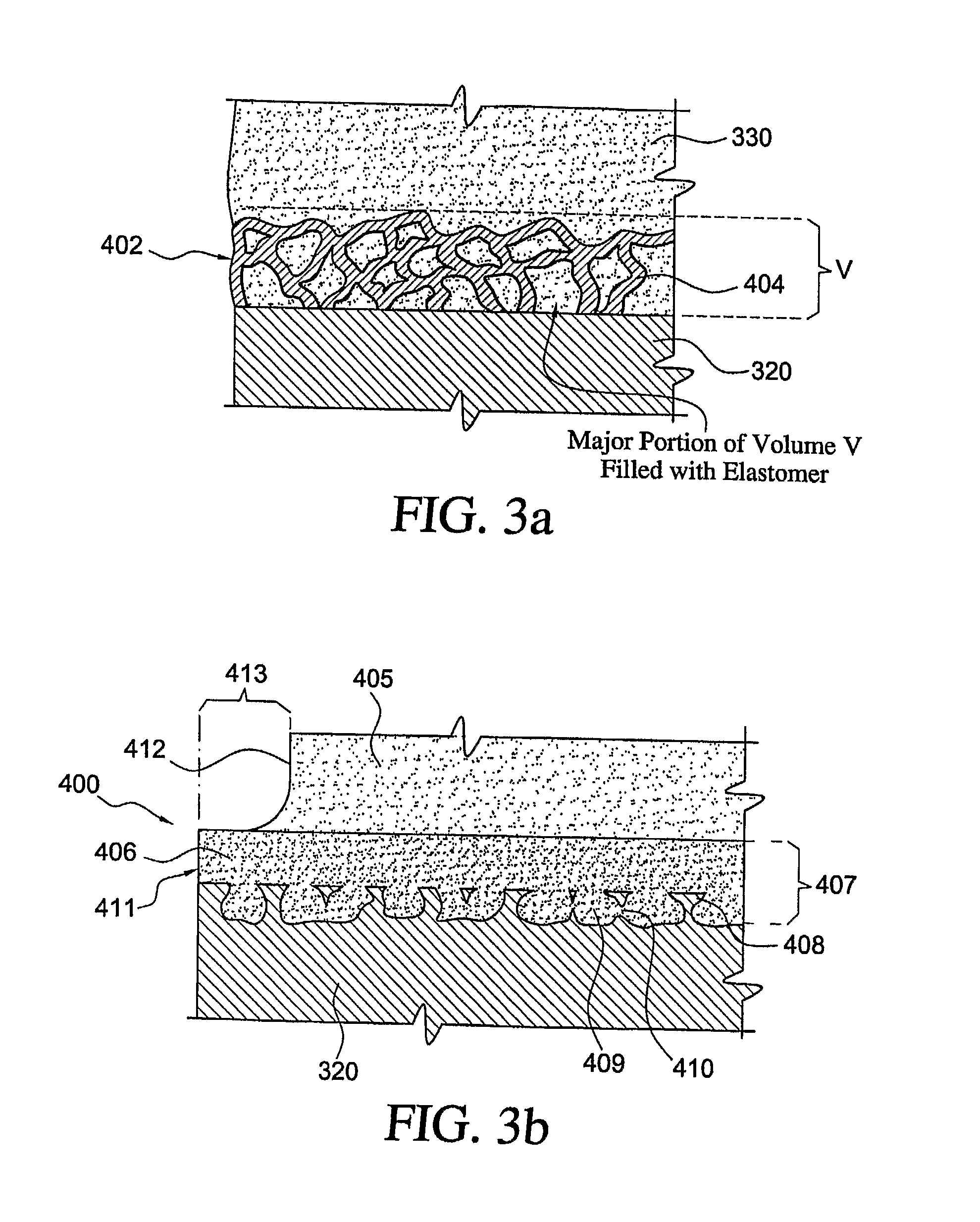 Fixation of Elastomer to Rigid Structures