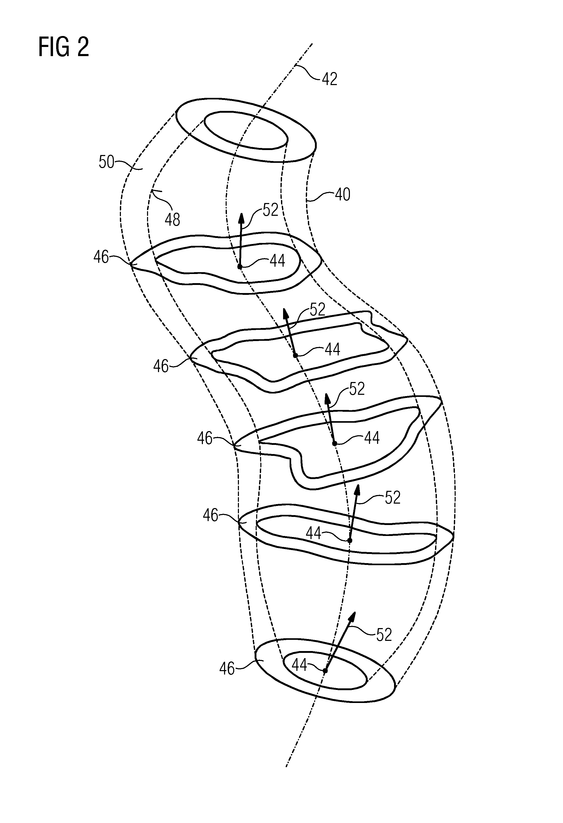 Catheter with ultrasound sensor and method for creating a volume graphic by means of the catheter