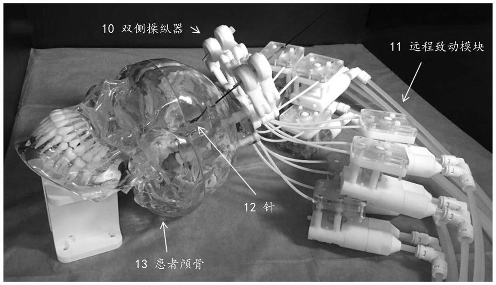 Robotic stereotactic system for mri-guided neurosurgery