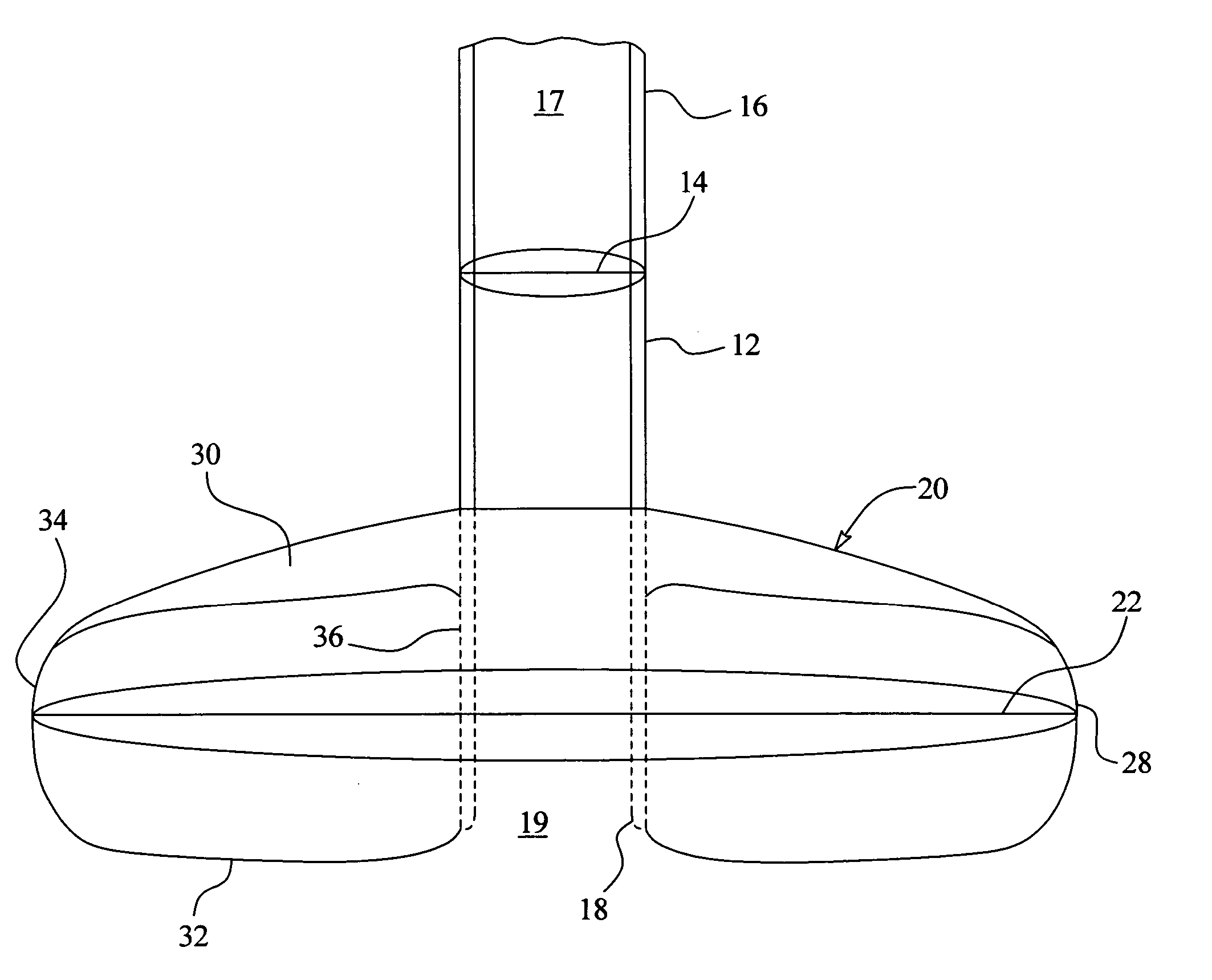 System and method for securing a medical access device