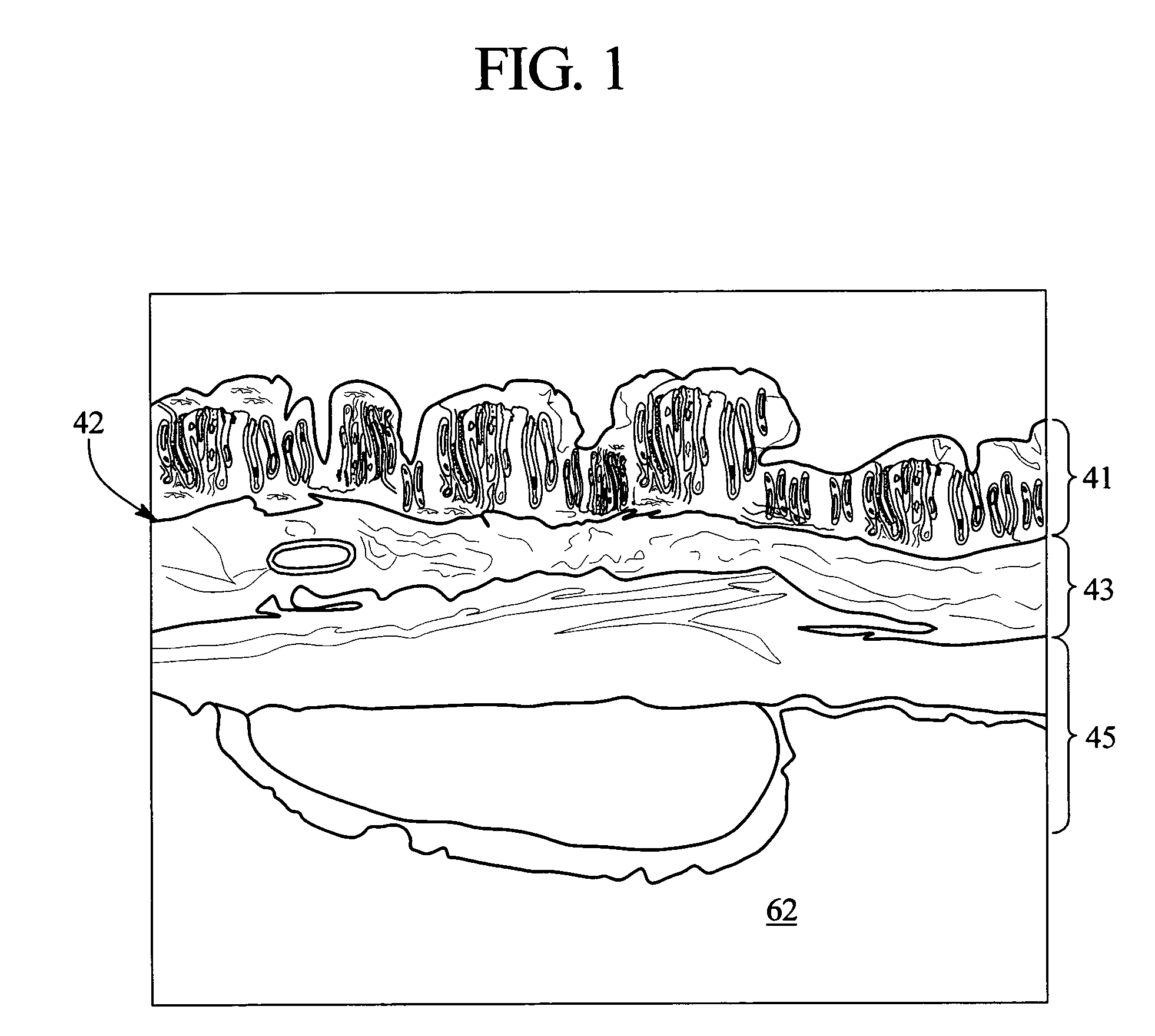 System and method for securing a medical access device