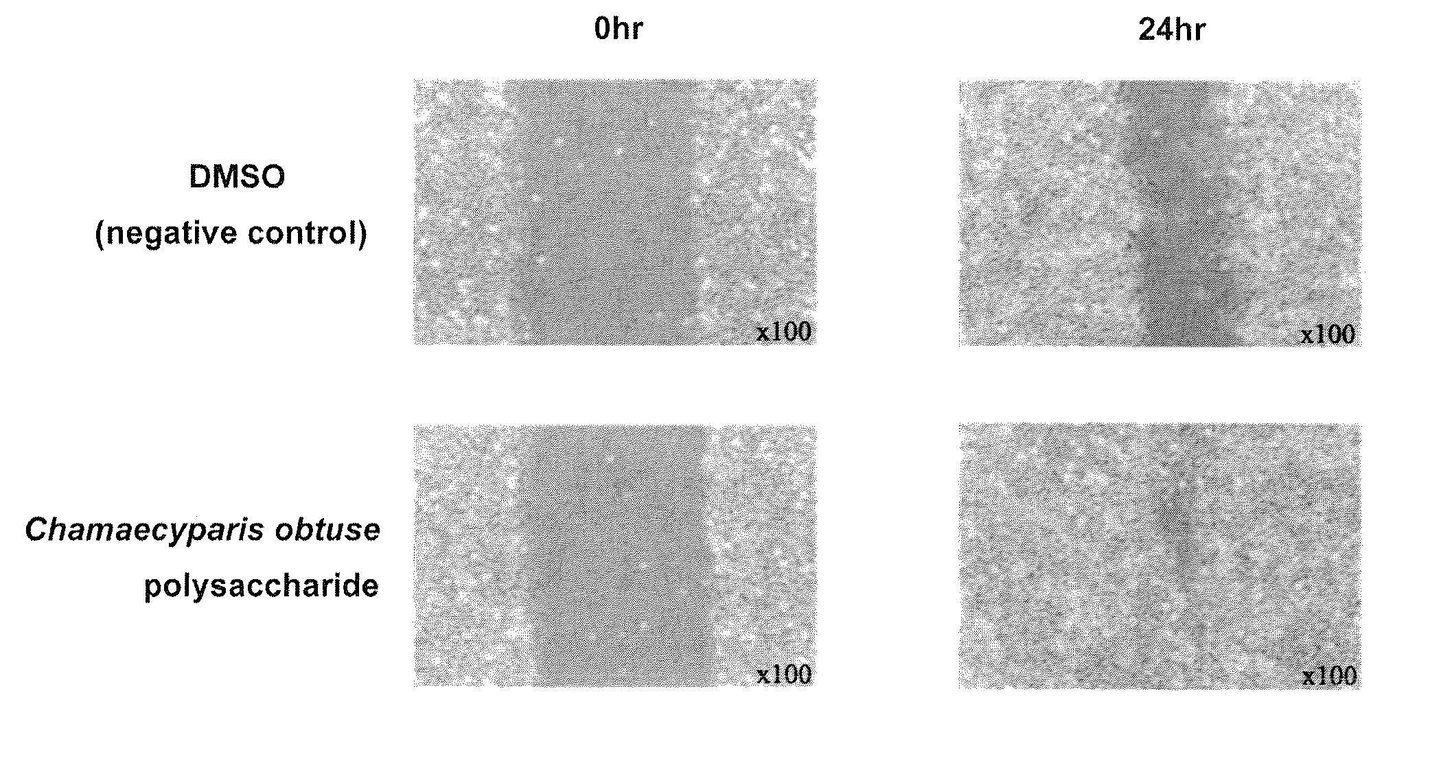 Composition containing Chamaecyparis obtusa polysaccharides to be externally applied to the skin