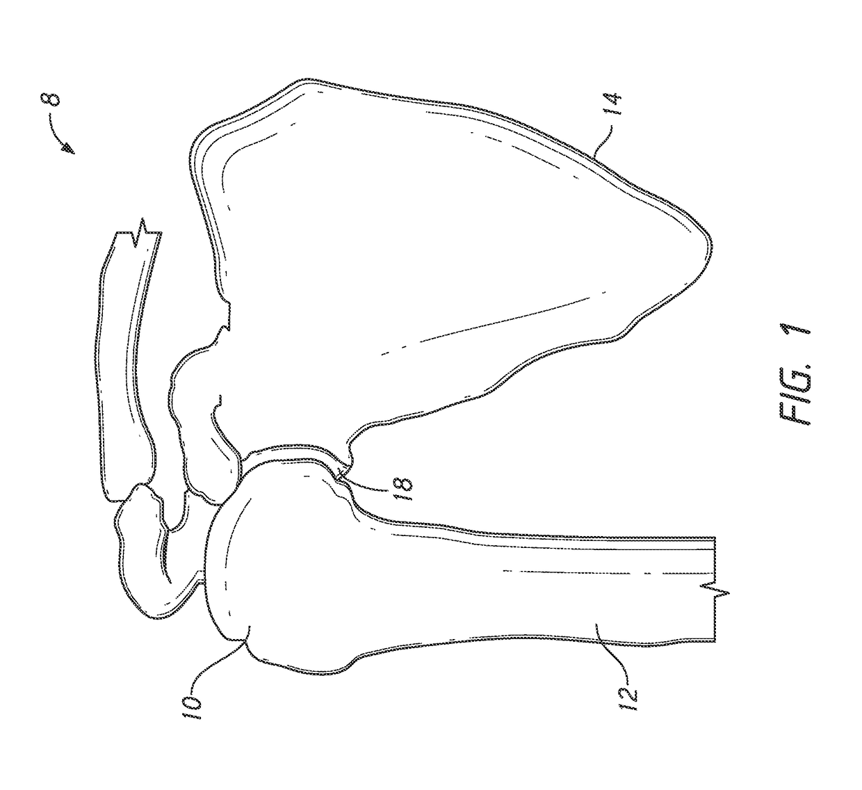 Guides and instruments for improving accuracy of glenoid implant placement