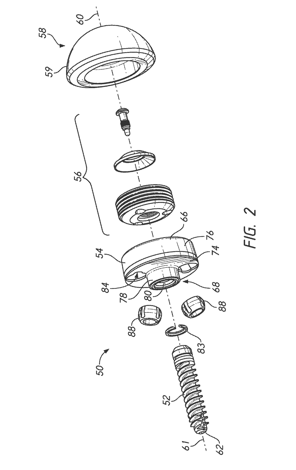 Guides and instruments for improving accuracy of glenoid implant placement