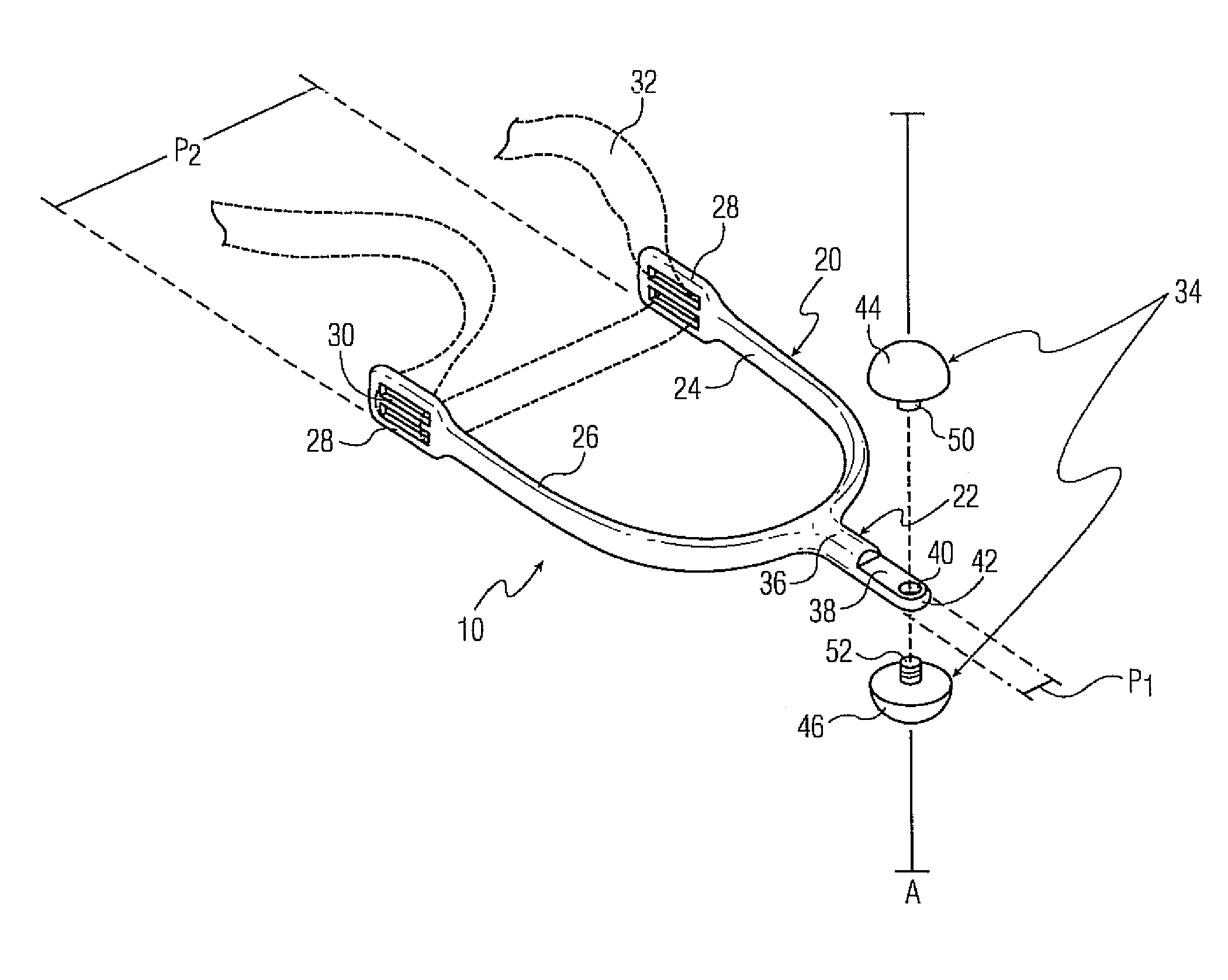 Spur with Removable End Piece