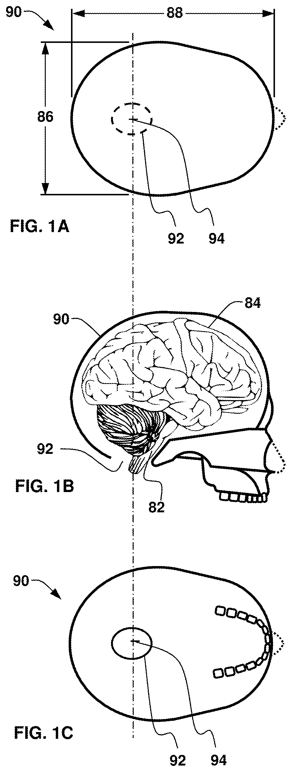 Ocular parameter-based head impact measurement using a face shield