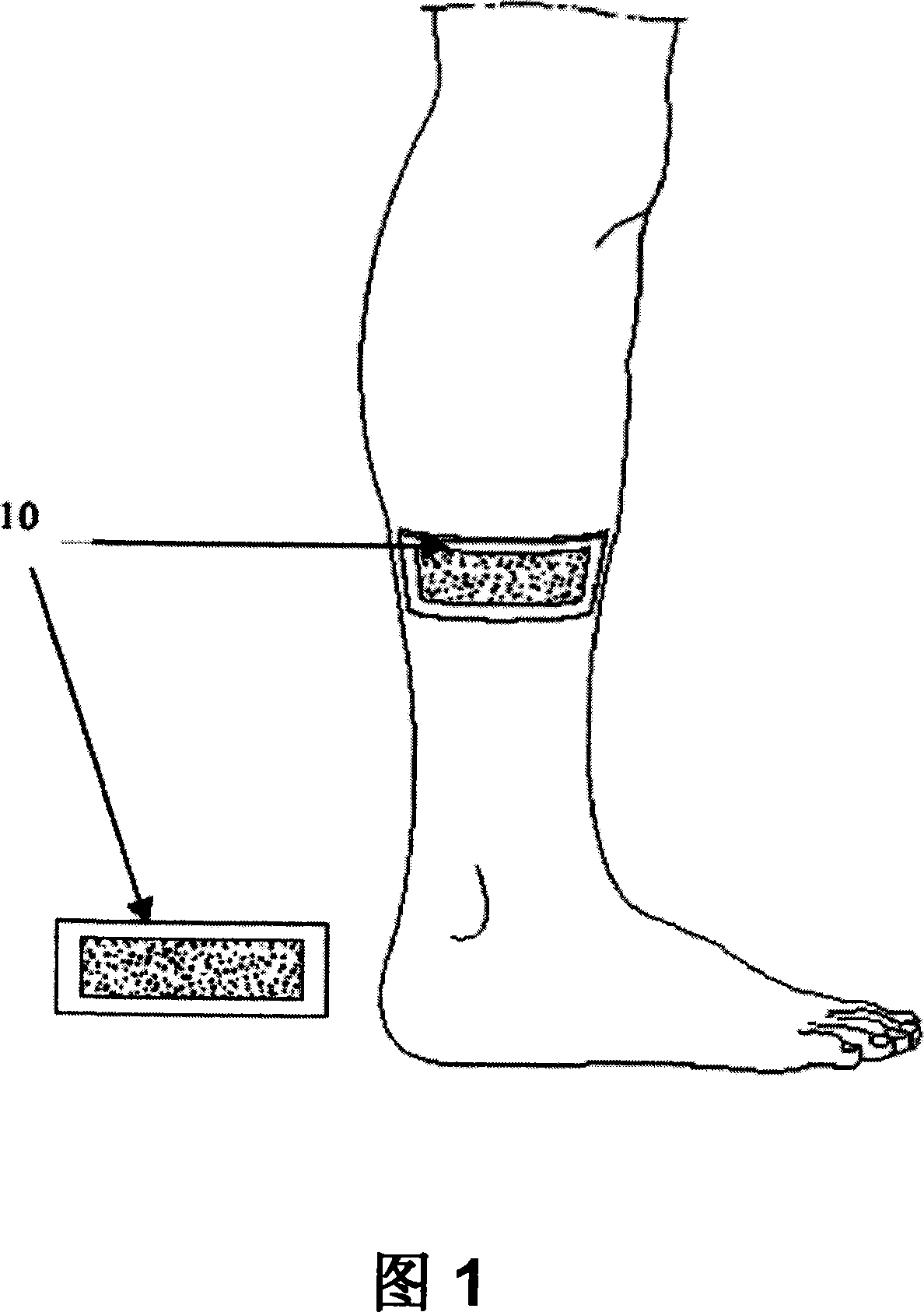 Treatment and pre-treatment device comprising nitric oxide and producing method thereof