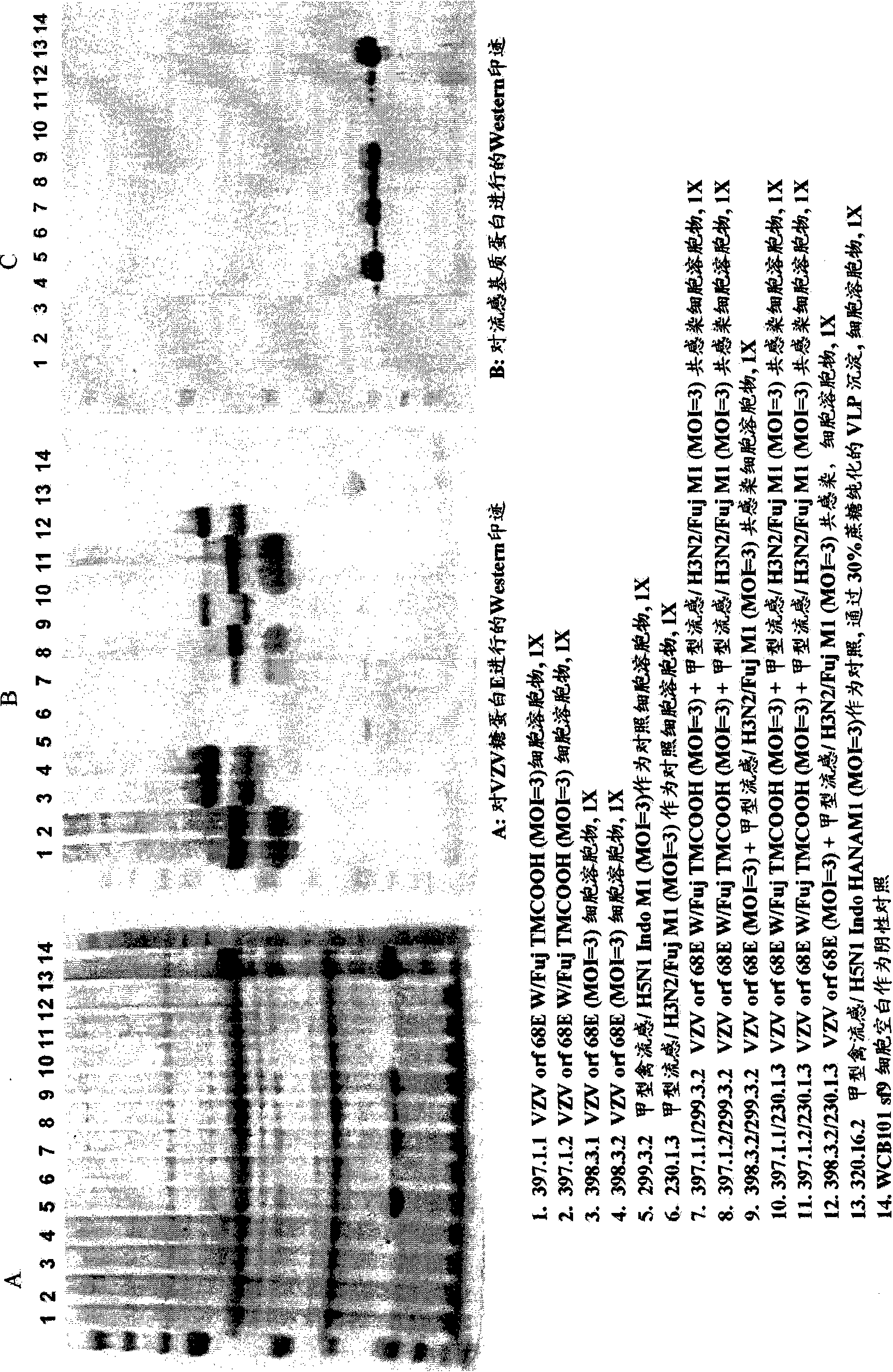 Varicella zoster virus-virus like particles (VLPS) and antigens