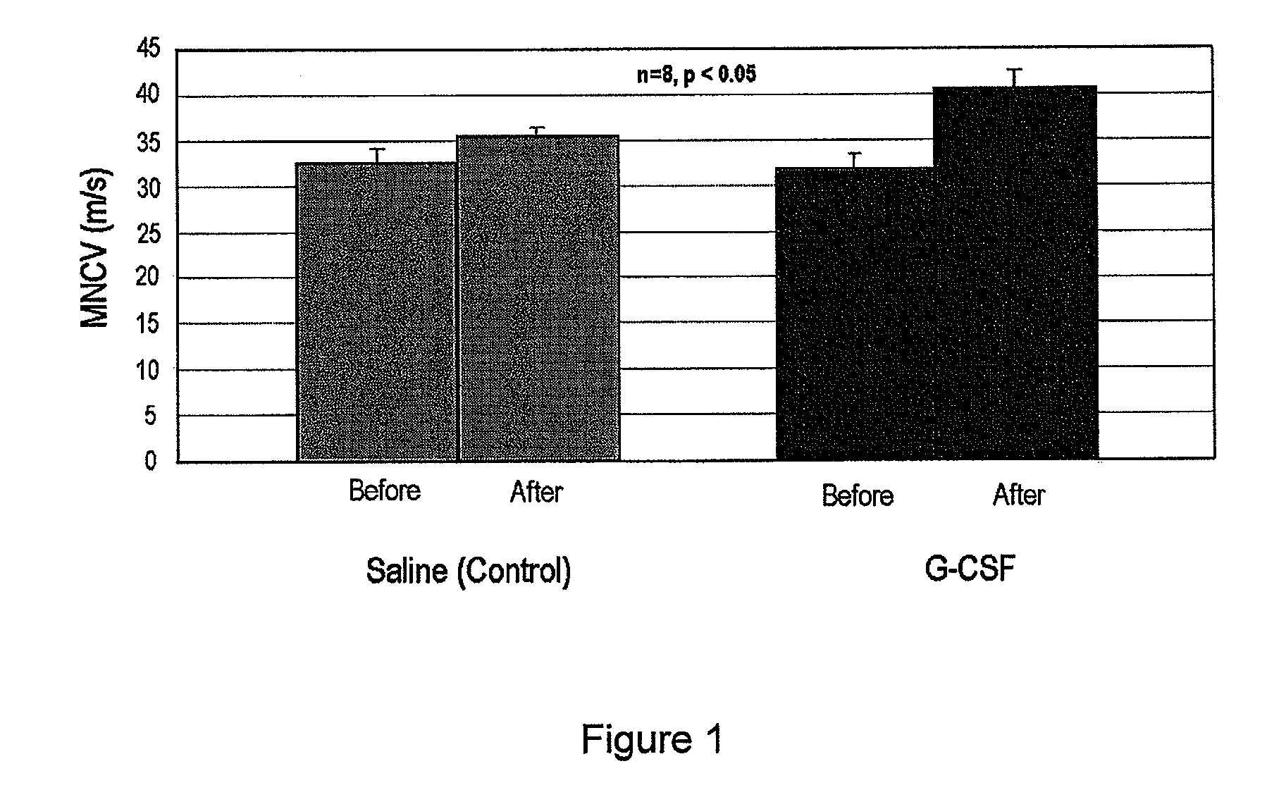 Agent comprising g-csf for prevention and treatment of diabetic peripheral neuropathy