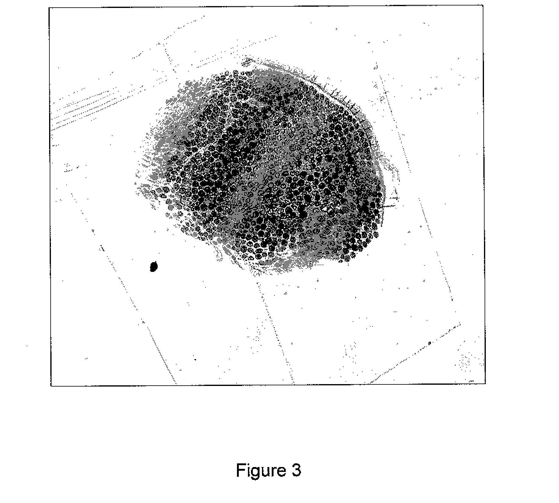 Agent comprising g-csf for prevention and treatment of diabetic peripheral neuropathy