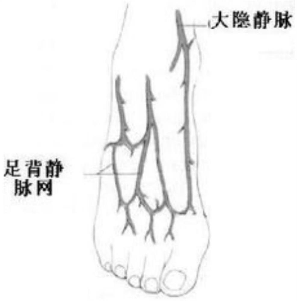 Great Saphenous Vein Availability Analysis System