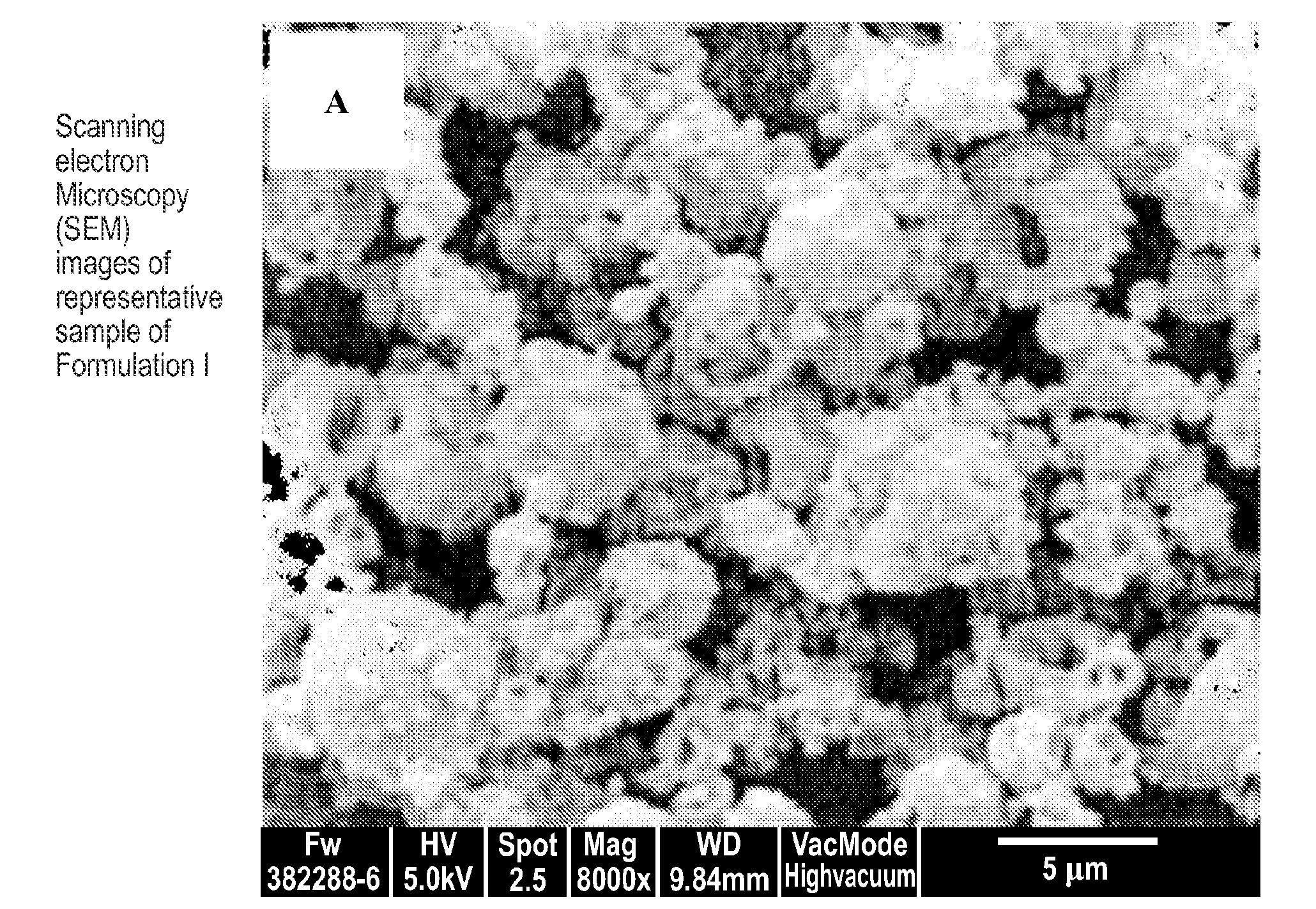 Dry powder formulations and methods for treating pulmonary diseases