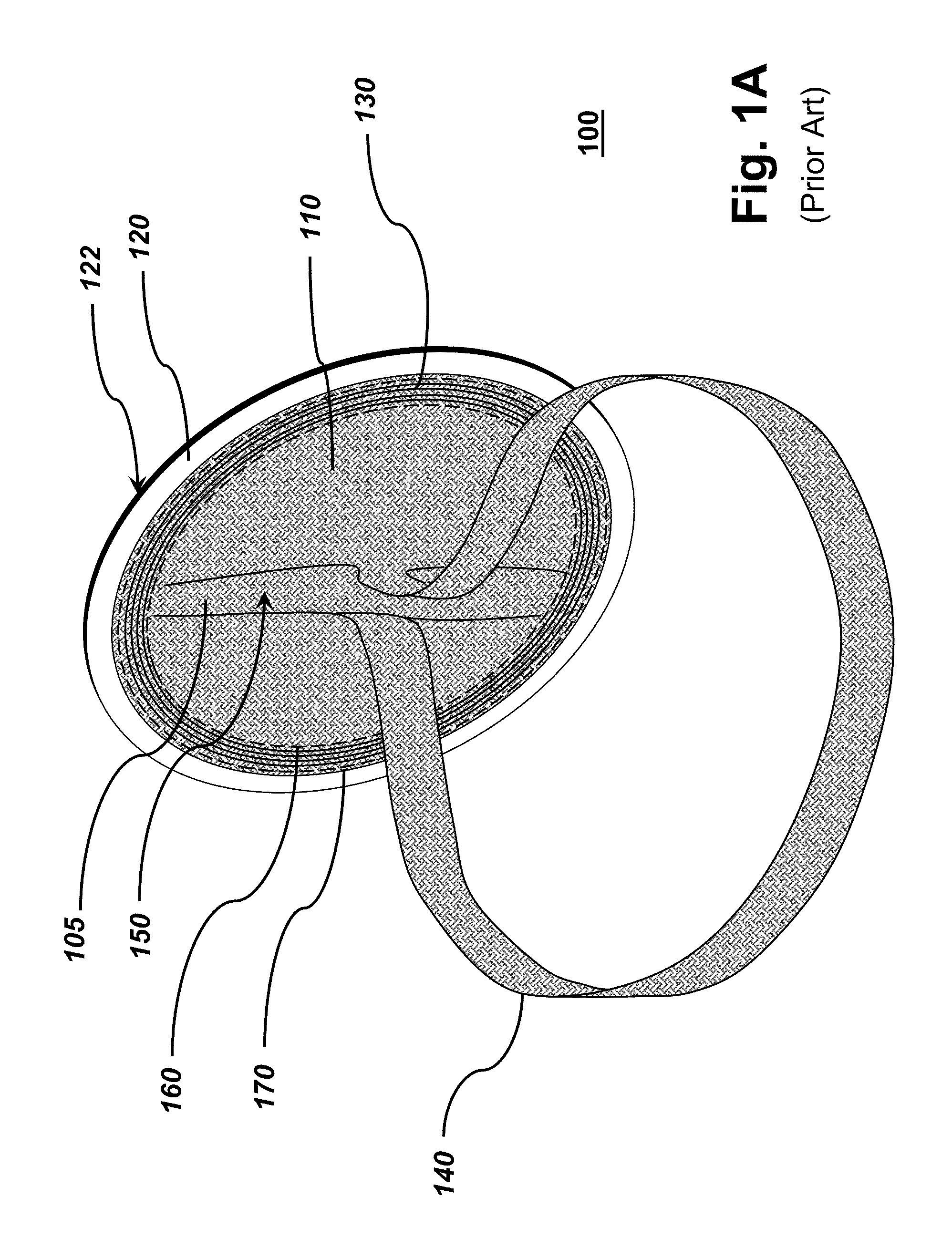 Hernia patch