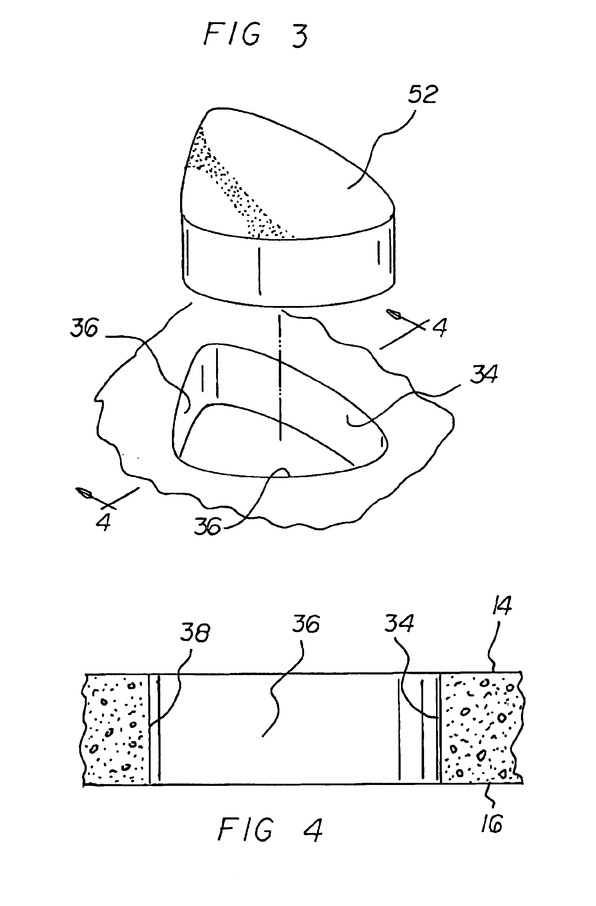 Therapeutic mattress system