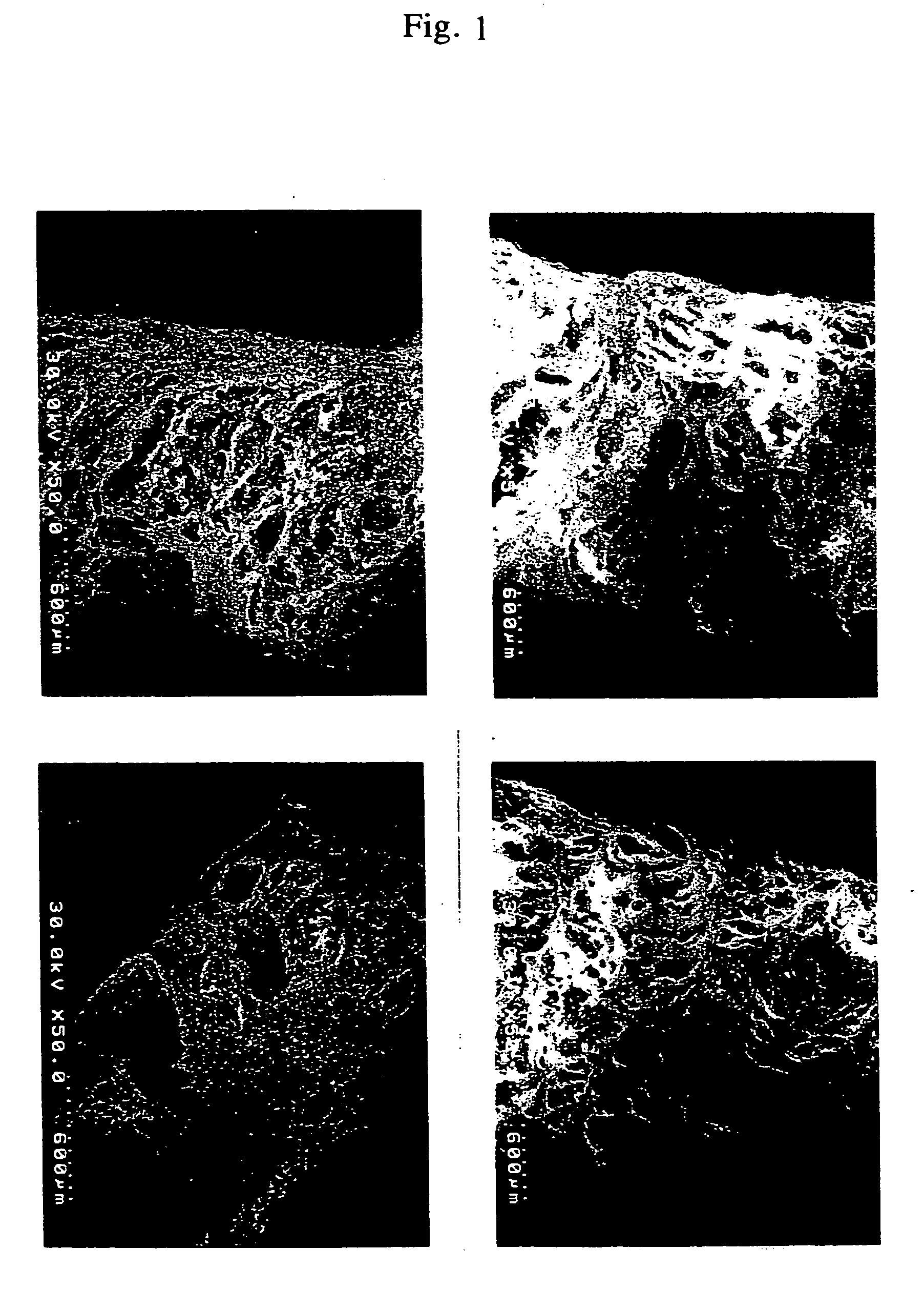 Composite biomaterials