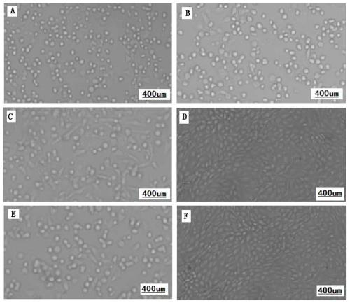 A kind of goat pox, sheep pox, aphthous triple cell attenuated vaccine and its preparation method and application