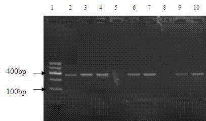 Method for detecting medicine-resistance mutation of tyrosine-methionineaspartate-aspartate (YMDD) of hepatitis B virus