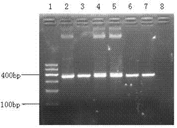 Method for detecting medicine-resistance mutation of tyrosine-methionineaspartate-aspartate (YMDD) of hepatitis B virus