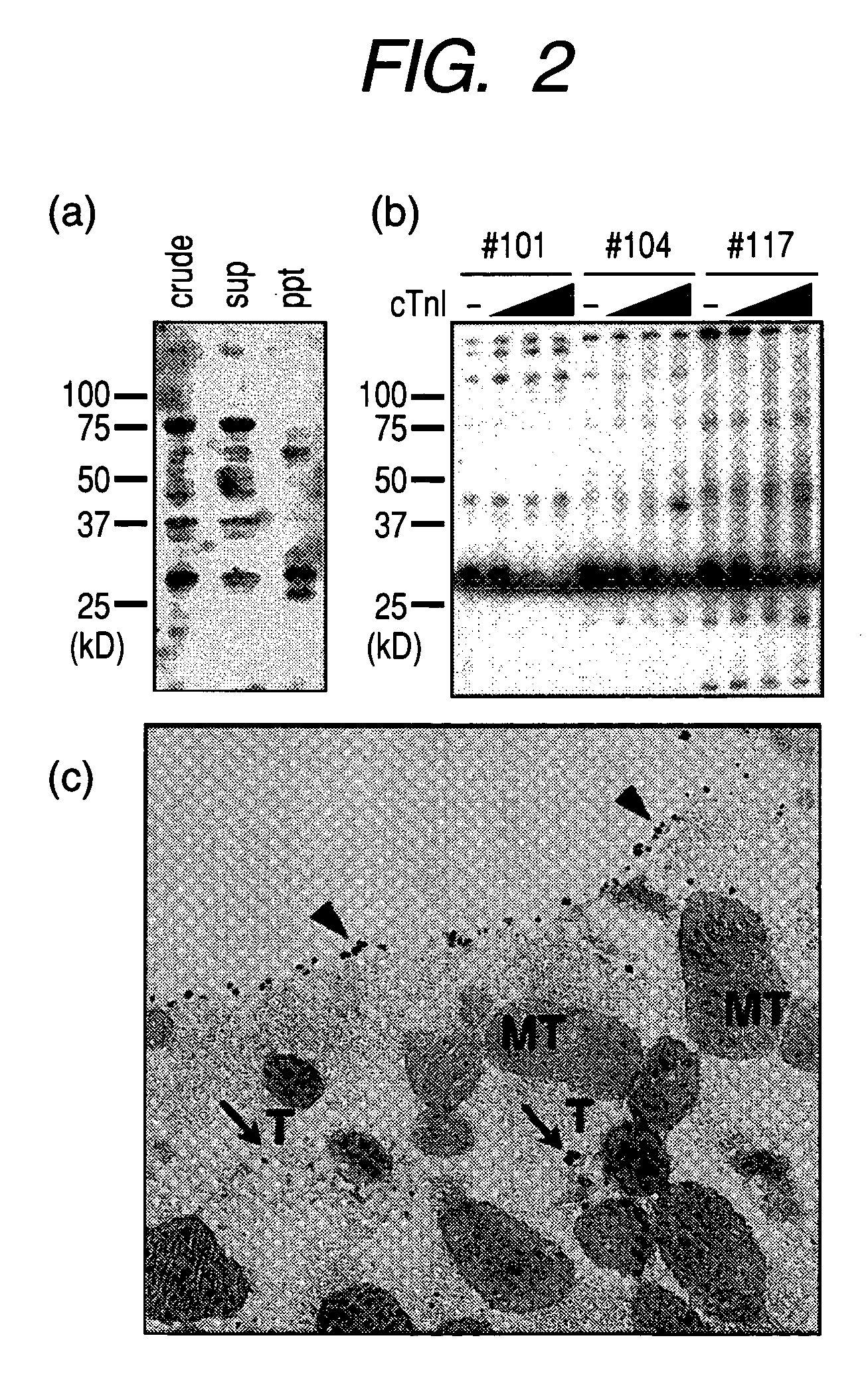 Method of screening remedy for heart disease and medicinal composition for treating heart disease