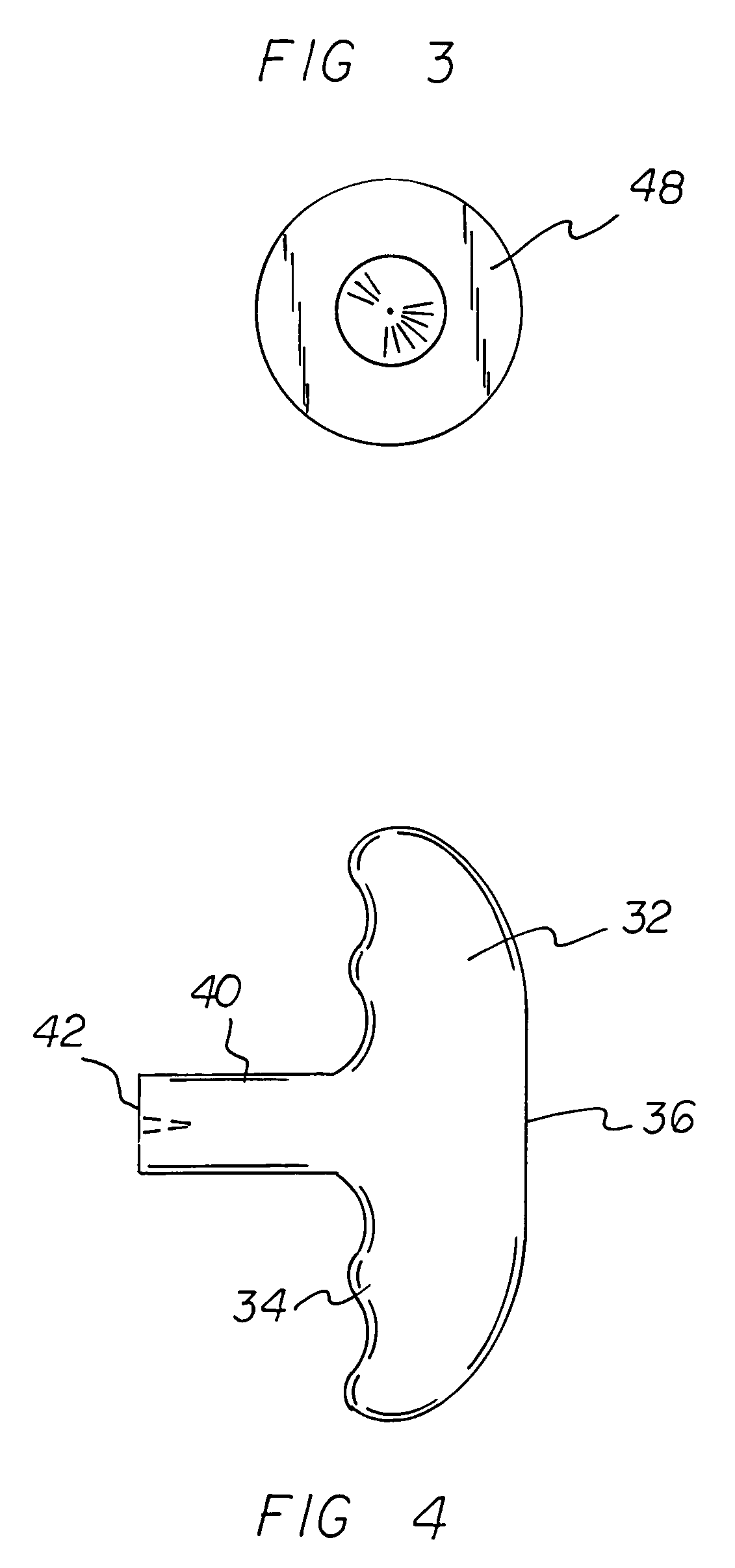 Straightening system