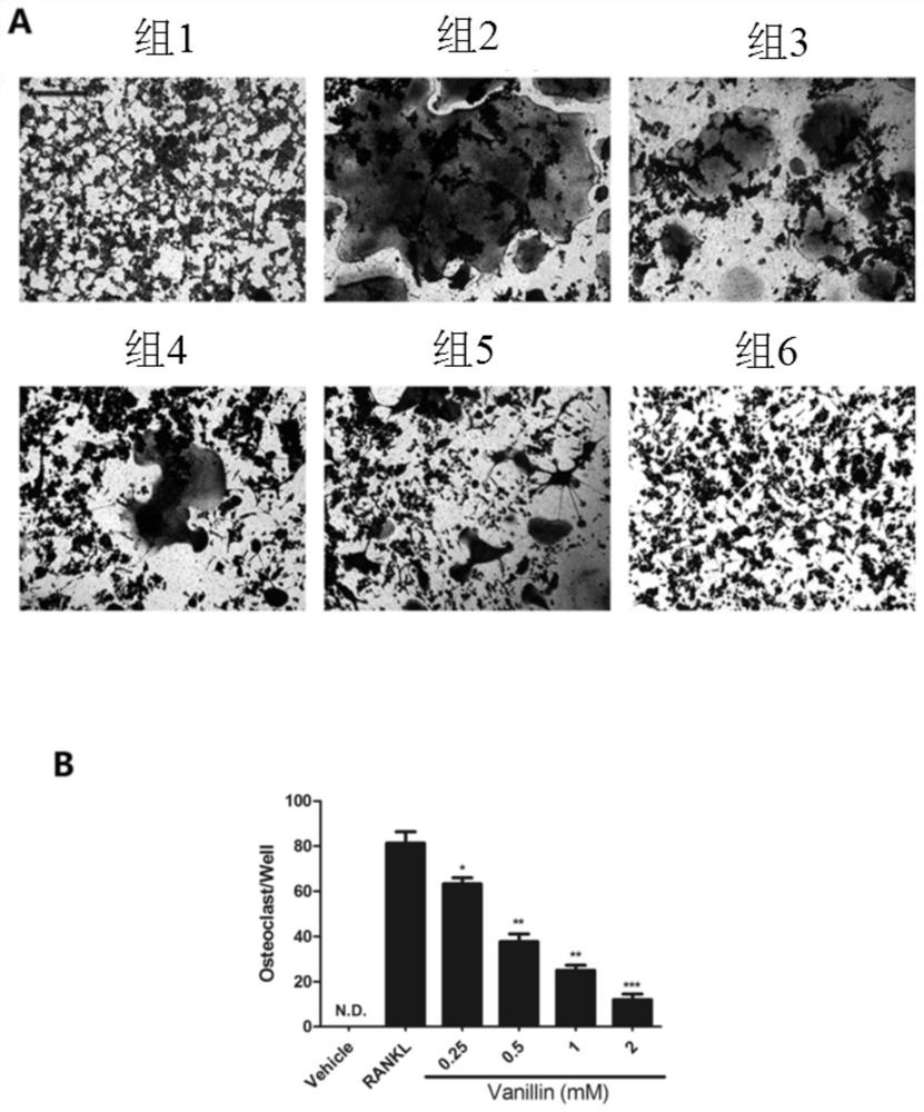 Application of vanillin in the preparation of medicines for treating/preventing bone metabolic diseases