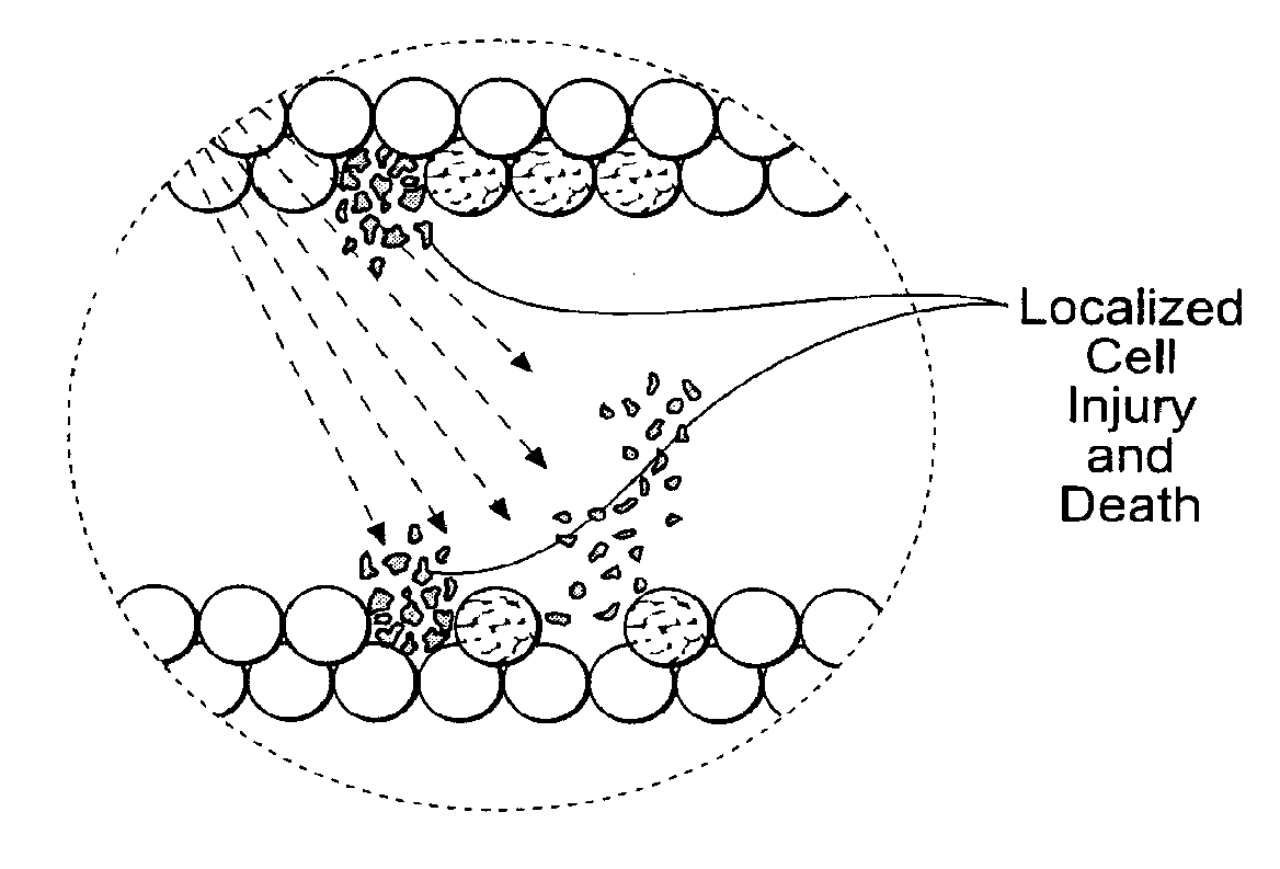 Systems and methods for treating superficial venous malformations like spider veins