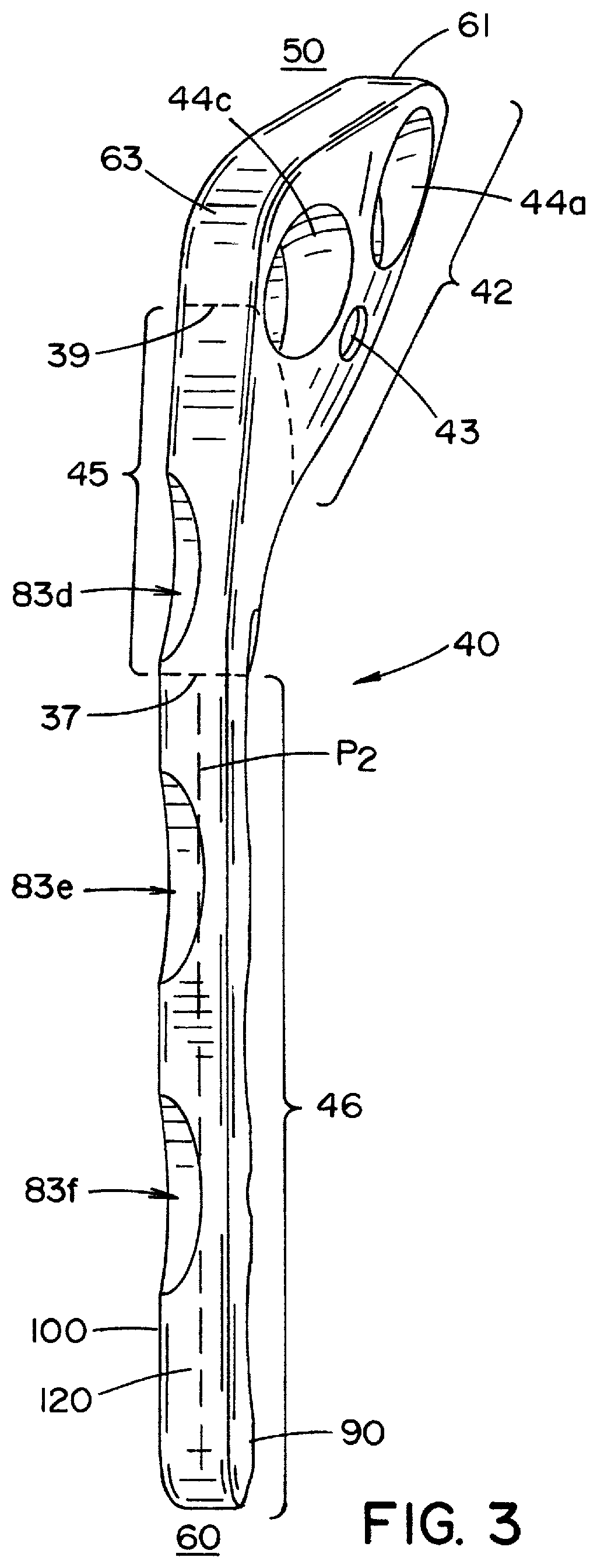 Tibial fixation plate