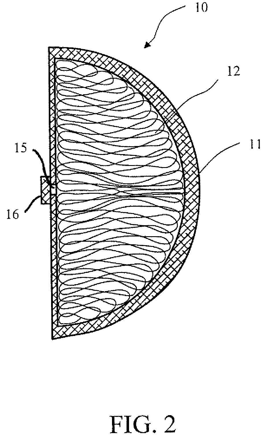 Breast implant and method of manufacture