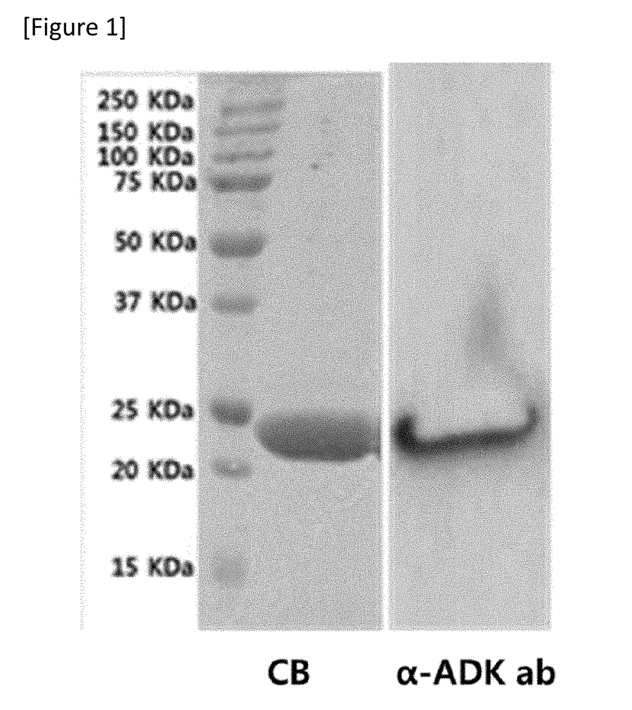 Compositions for preventing or treating sepsis or septic shock comprising adk protein as active ingredient