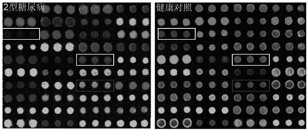 Lectin test chip for saliva sample, and treatment method thereof