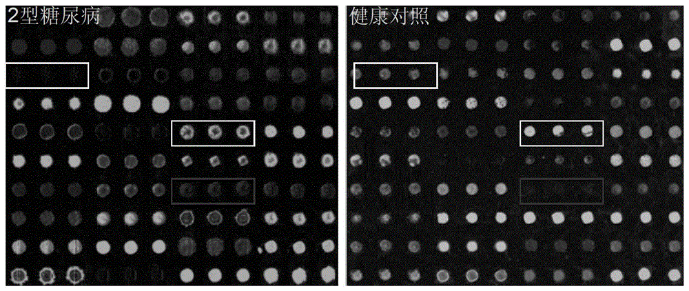 Lectin test chip for saliva sample, and treatment method thereof